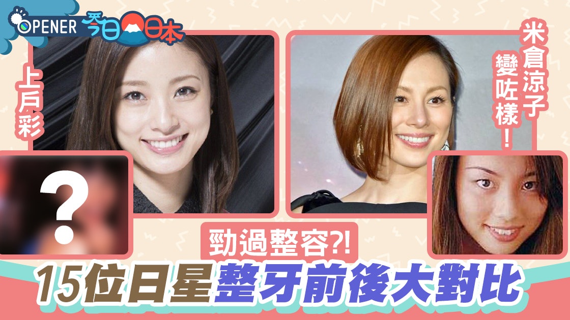 松坂桃李齙牙超嚇人 大島優子虎牙消失 15位日星整牙前後大對比 香港01 開罐 松坂桃李齙牙超嚇人 大島優子虎牙消失 15位日星整牙前後大對比 香港01 開罐