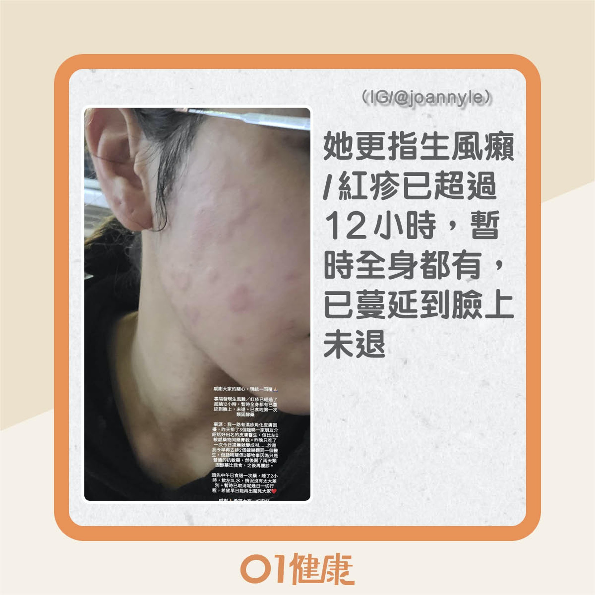 利穎怡生風癩情況(01製圖) 利穎怡生風癩情況(01製圖)