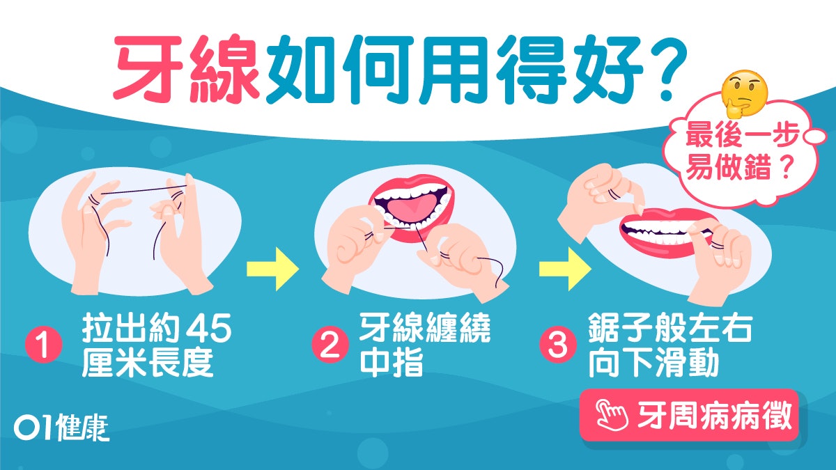牙線用法|1個牙縫1段線正確使用4貼士 5個常犯錯誤卡食物才用? 牙線用法|1個牙縫1段線正確使用4貼士 5個常犯錯誤卡食物才用?