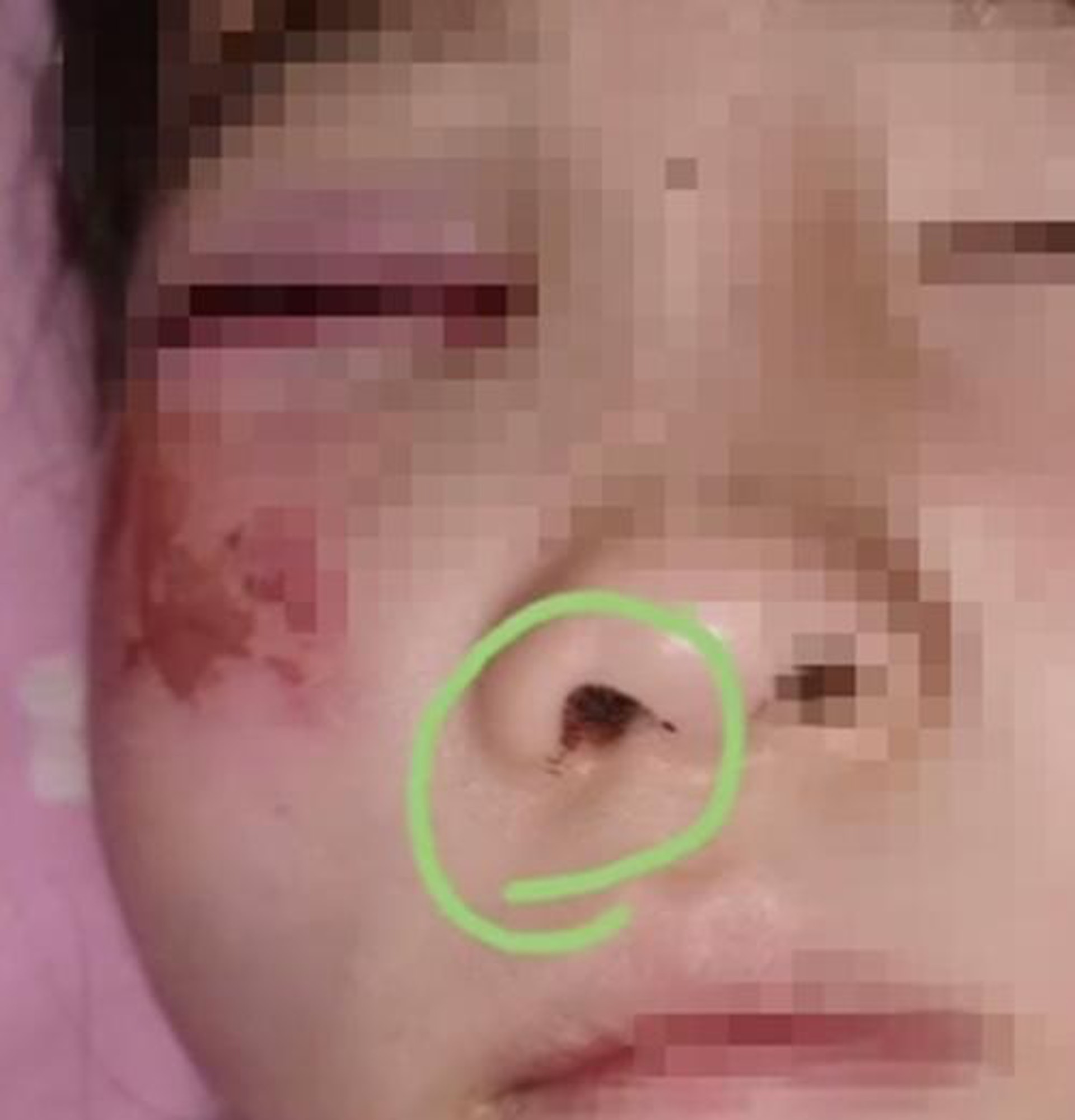 女童右眼和右臉嚴重受傷。（影片截圖）