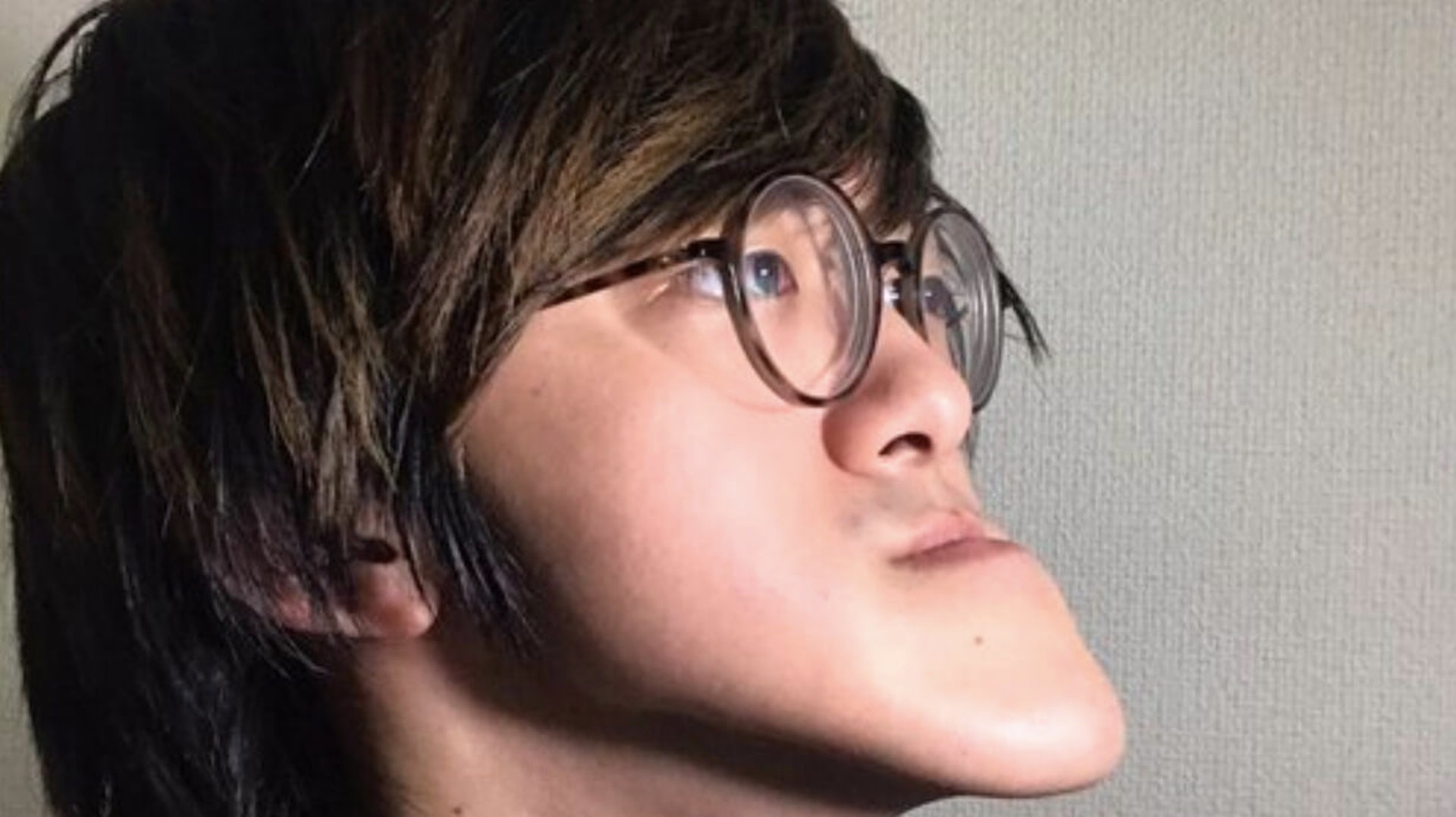 這名因下巴過長而引起熱話的日本Youtuber,早前在影片分享自己經歷。(Youtube截圖) 這名因下巴過長而引起熱話的日本Youtuber,早前在影片分享自己經歷。(Youtube截圖)