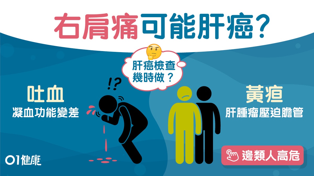 肝癌|右肩痛吐血肝癌3大警號!肥胖脂肪肝7類人高危留意大便? 肝癌|右肩痛吐血肝癌3大警號!肥胖脂肪肝7類人高危留意大便?