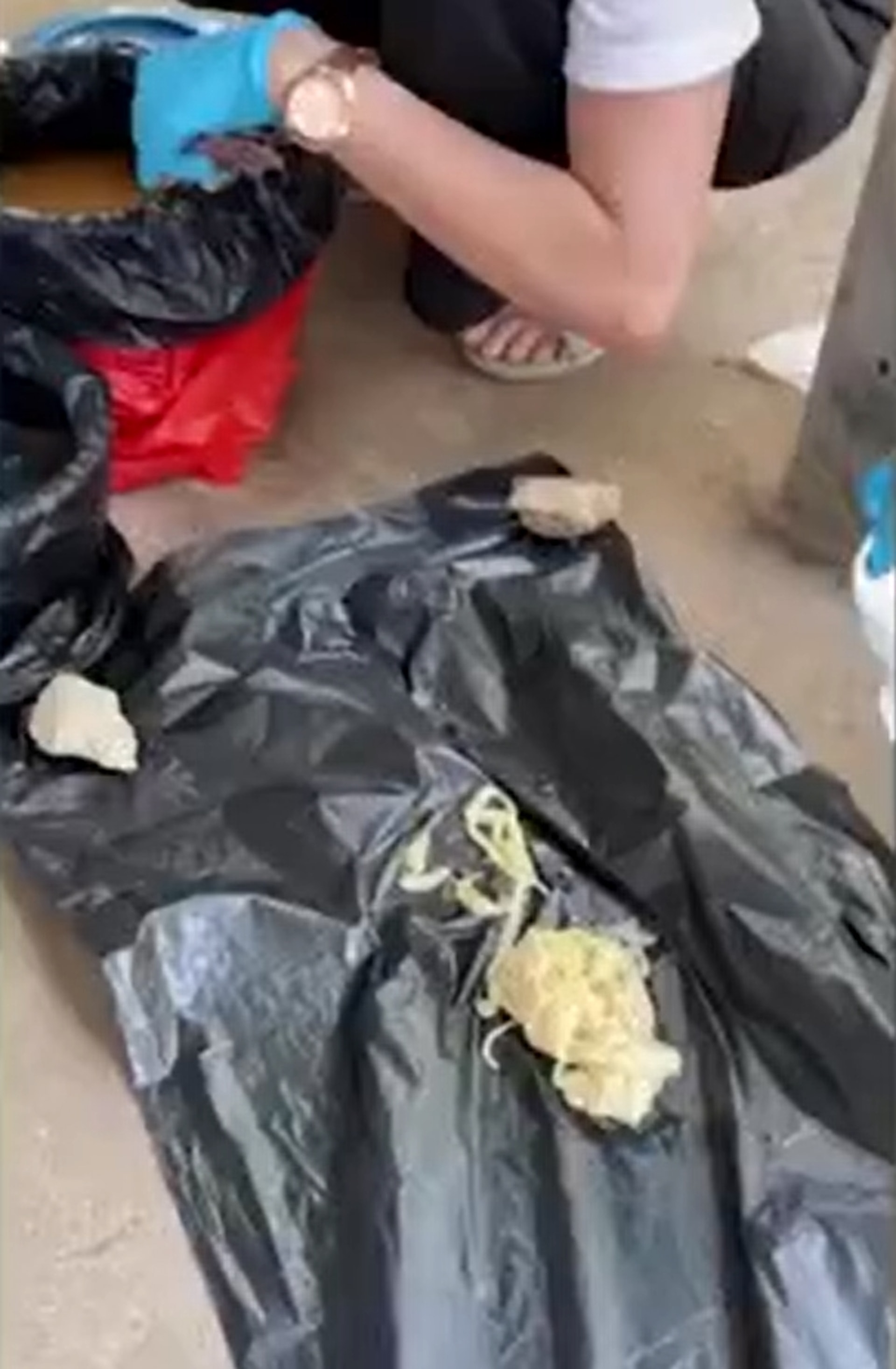 泰國男子糞便檢查驗出蟲卵,服藥後竟排出18米長大蟲。(影片截圖:路透社) 泰國男子糞便檢查驗出蟲卵,服藥後竟排出18米長大蟲。(影片截圖:路透社)