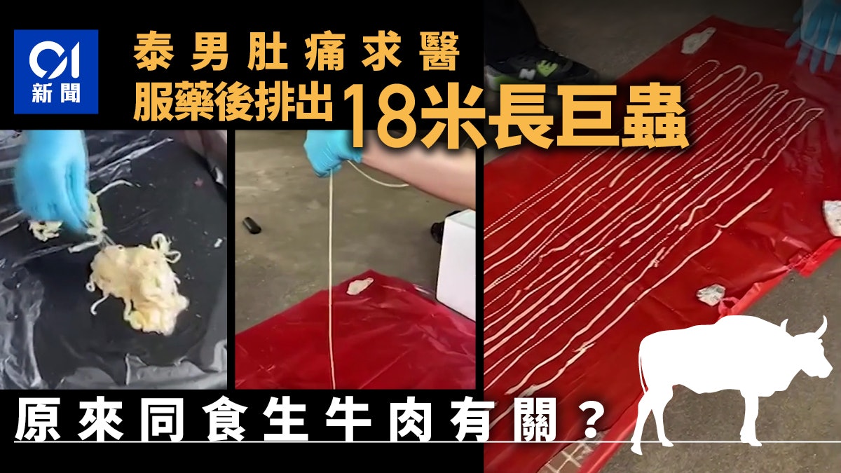細思極恐|糞便檢查驗出蟲卵 泰國男子服藥後竟排出18米長大蟲 細思極恐|糞便檢查驗出蟲卵 泰國男子服藥後竟排出18米長大蟲