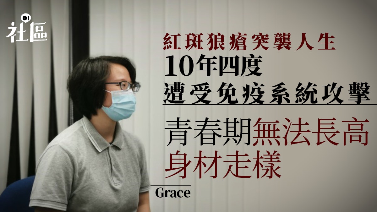 紅斑狼瘡女子10年內四度發病 毋懼逆境修讀心理學盼助病友 紅斑狼瘡女子10年內四度發病 毋懼逆境修讀心理學盼助病友