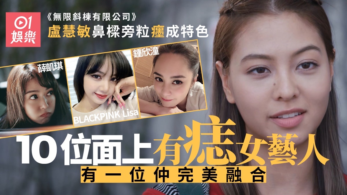 無限斜棟︱盧慧敏鼻樑旁有痣成特徵 盤點10位面上有癦女藝人 無限斜棟︱盧慧敏鼻樑旁有痣成特徵 盤點10位面上有癦女藝人