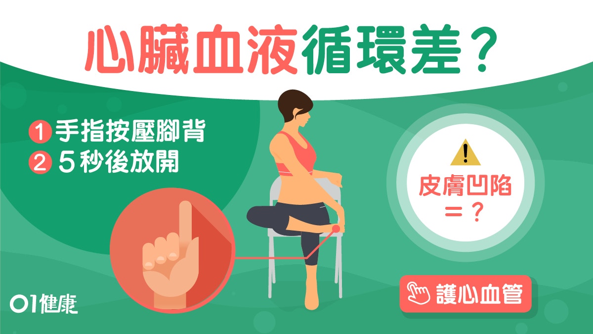 血液循環 腳水腫心臟血液循環差4個小測試睇手心就知肝出事 香港01 健康
