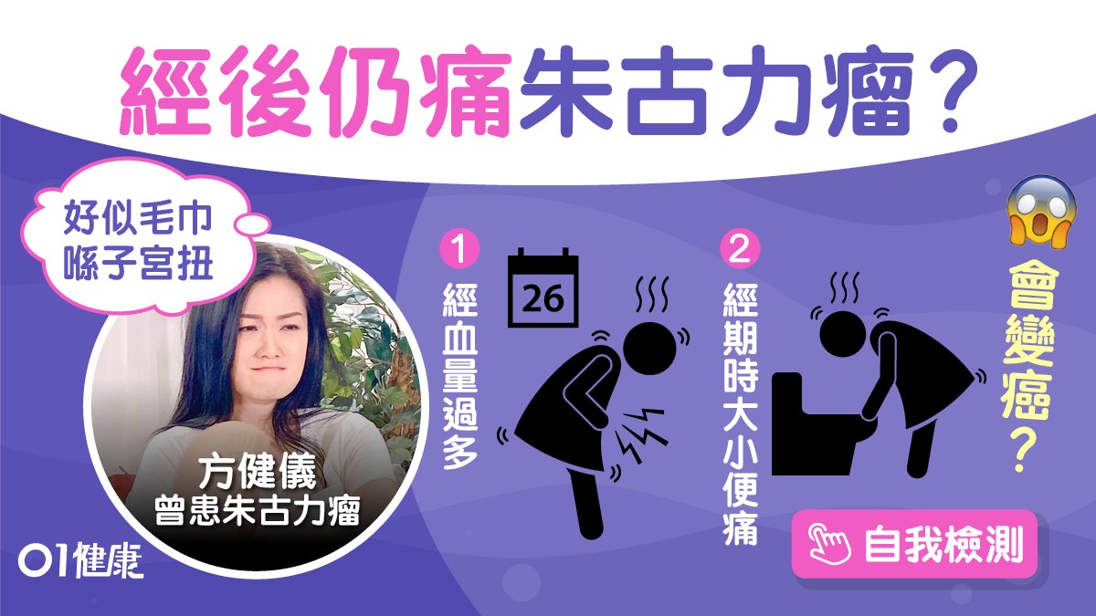 朱古力瘤|方健儀已割11厘米瘤籲經痛勿忍!11問題測風險或致不孕 朱古力瘤|方健儀已割11厘米瘤籲經痛勿忍!11問題測風險或致不孕