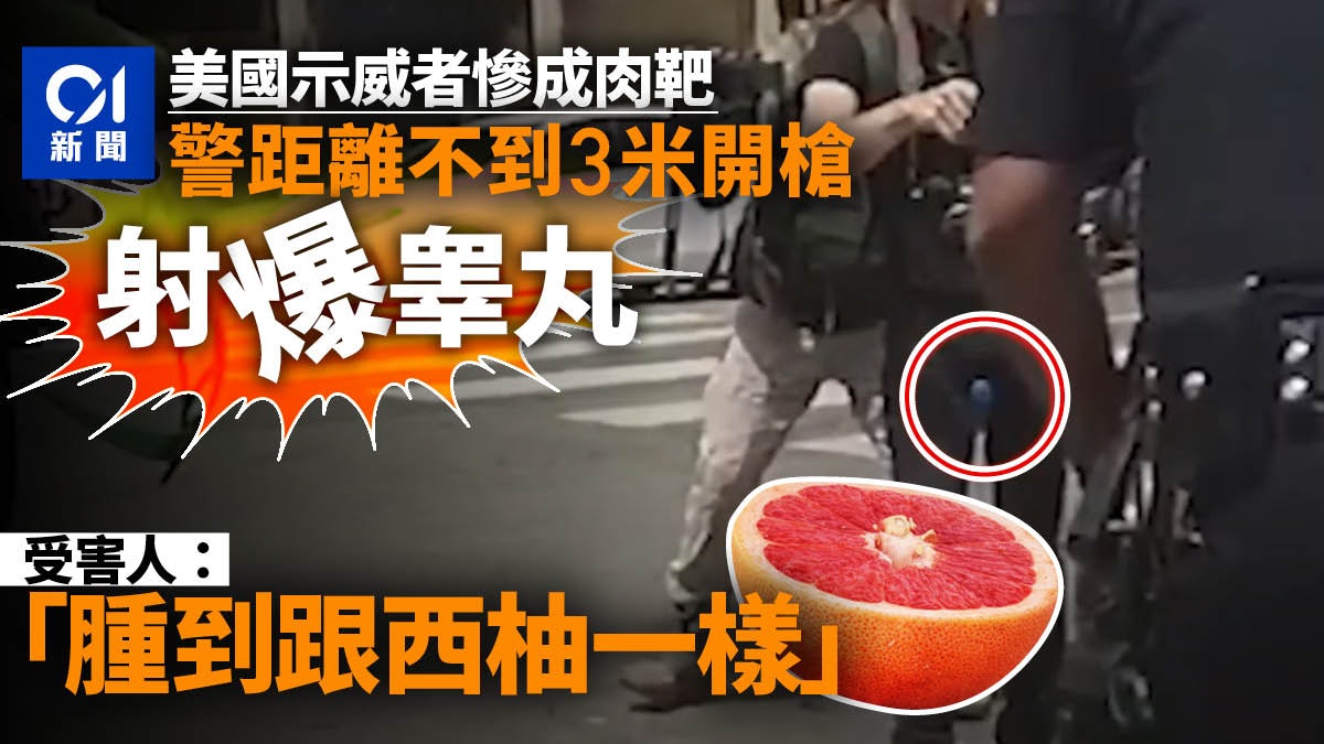 美國示威者遭瞄準 橡膠子彈「射爆睾丸」 警方否認做法不當 美國示威者遭瞄準 橡膠子彈「射爆睾丸」 警方否認做法不當