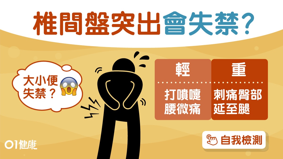 腰痛|肌肉痛或椎間盤突出?10秒檢測腰痛3原因1摸1敲知腎臟發炎! 腰痛|肌肉痛或椎間盤突出?10秒檢測腰痛3原因1摸1敲知腎臟發炎!