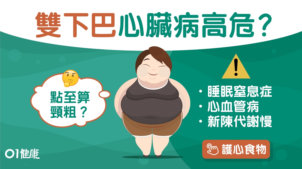 雙下巴｜頸短肉厚脂肪多易心肌梗塞3大毛病　戒2類食物防心血管病