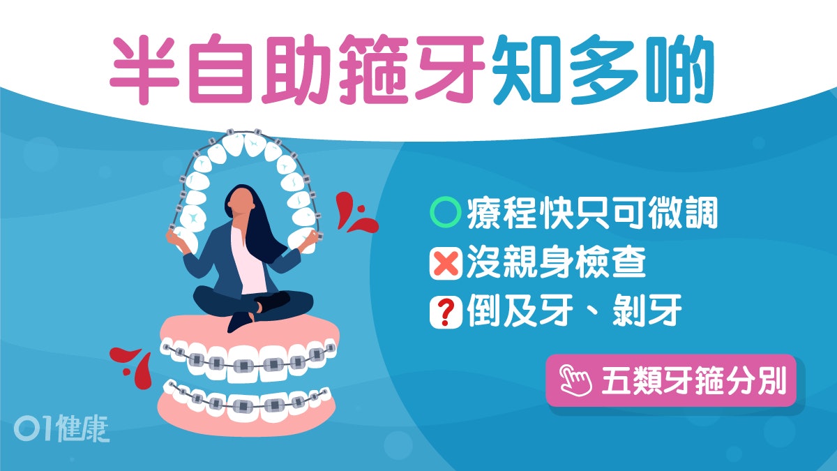 箍牙︱牙套遲到牙齒移位唔啱戴!半自助式箍牙3間比較唔使睇牙醫? 箍牙︱牙套遲到牙齒移位唔啱戴!半自助式箍牙3間比較唔使睇牙醫?