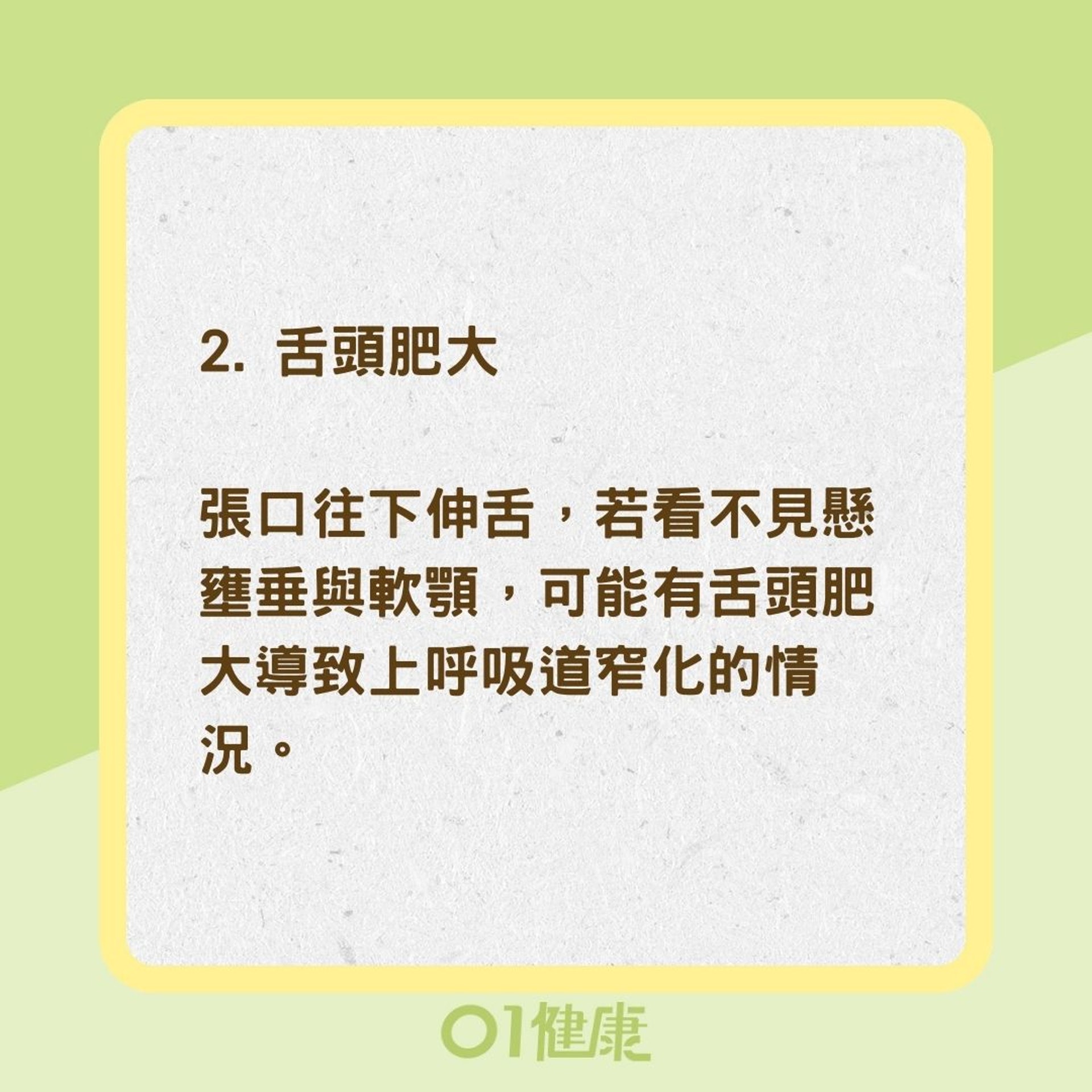 3個面相較易患有睡眠窒息症（01製圖）