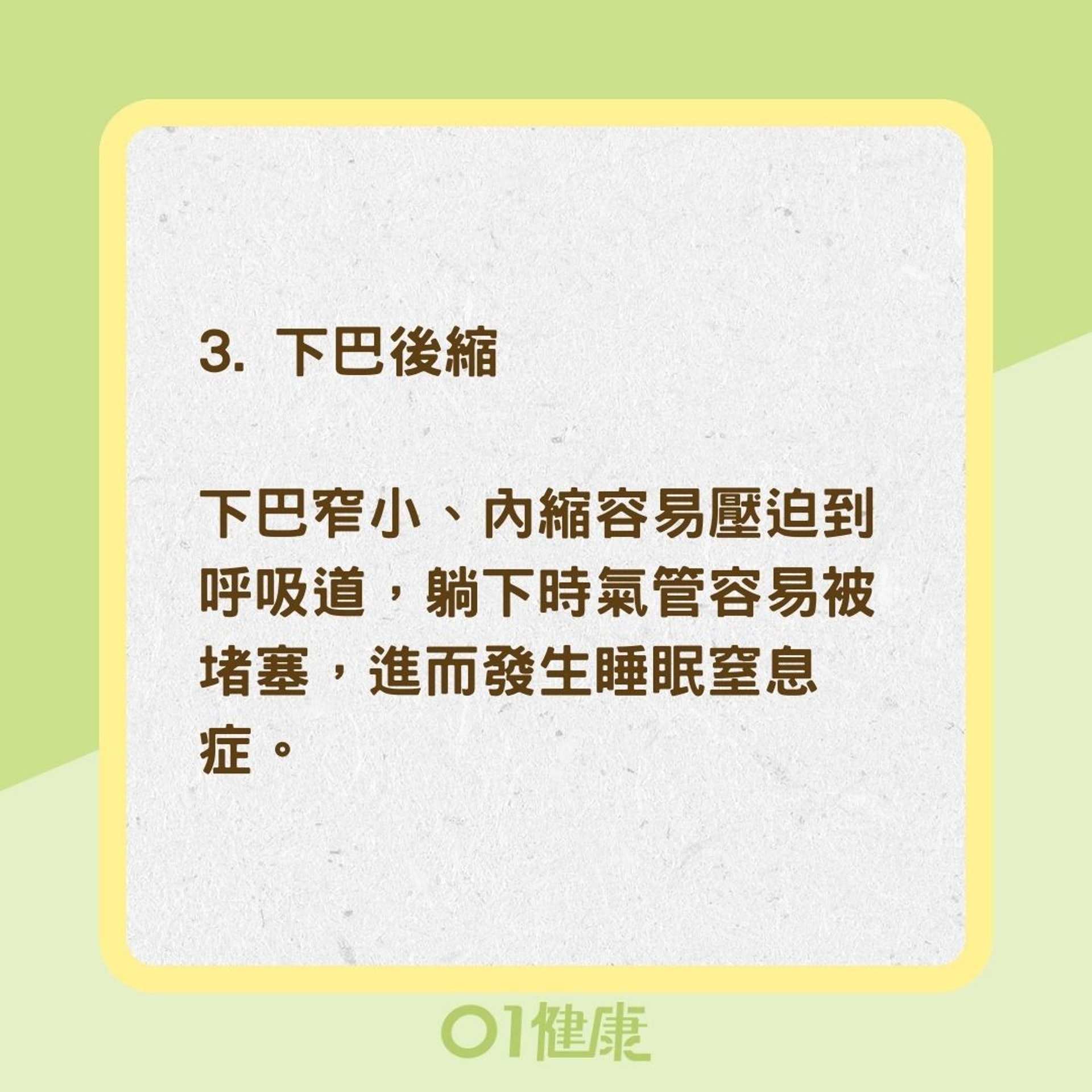 3個面相較易患有睡眠窒息症(01製圖) 3個面相較易患有睡眠窒息症(01製圖)