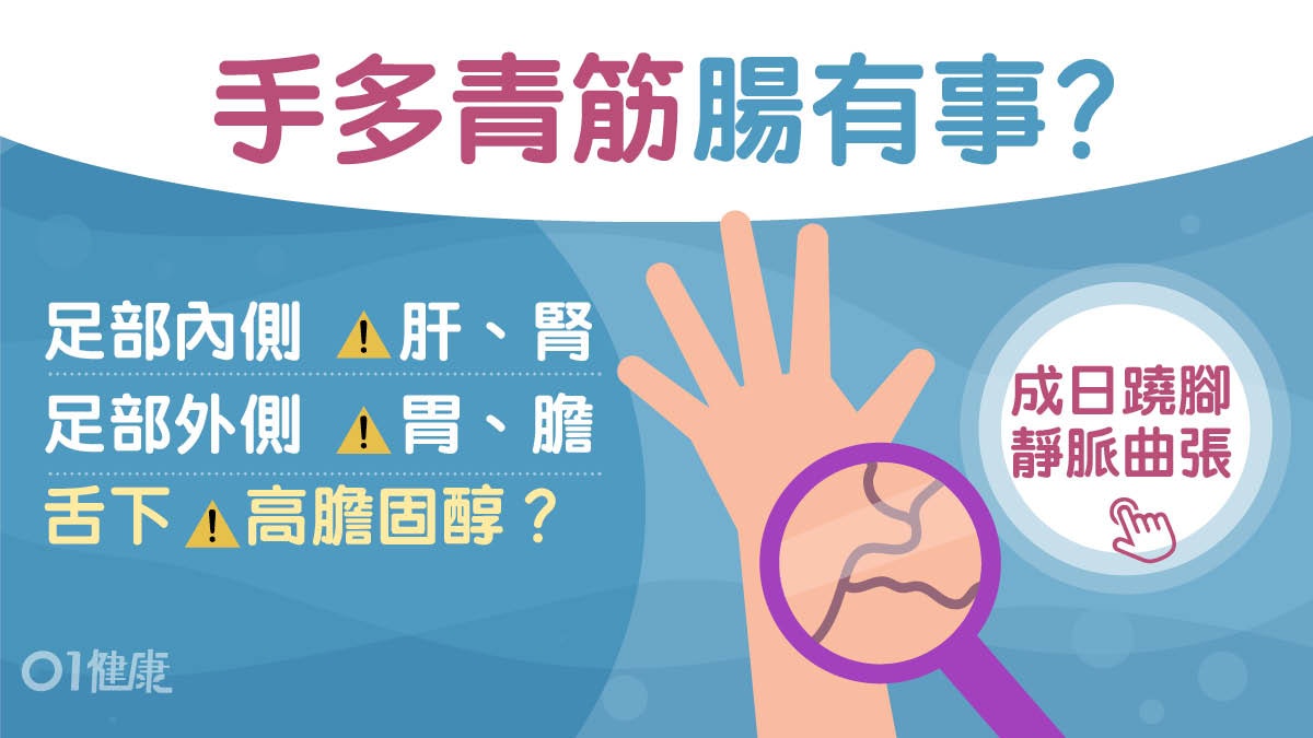 青筋位置|手背露青筋腸胃弱?5位置有冇三高竟睇呢度要多吃橙莓 青筋位置|手背露青筋腸胃弱?5位置有冇三高竟睇呢度要多吃橙莓