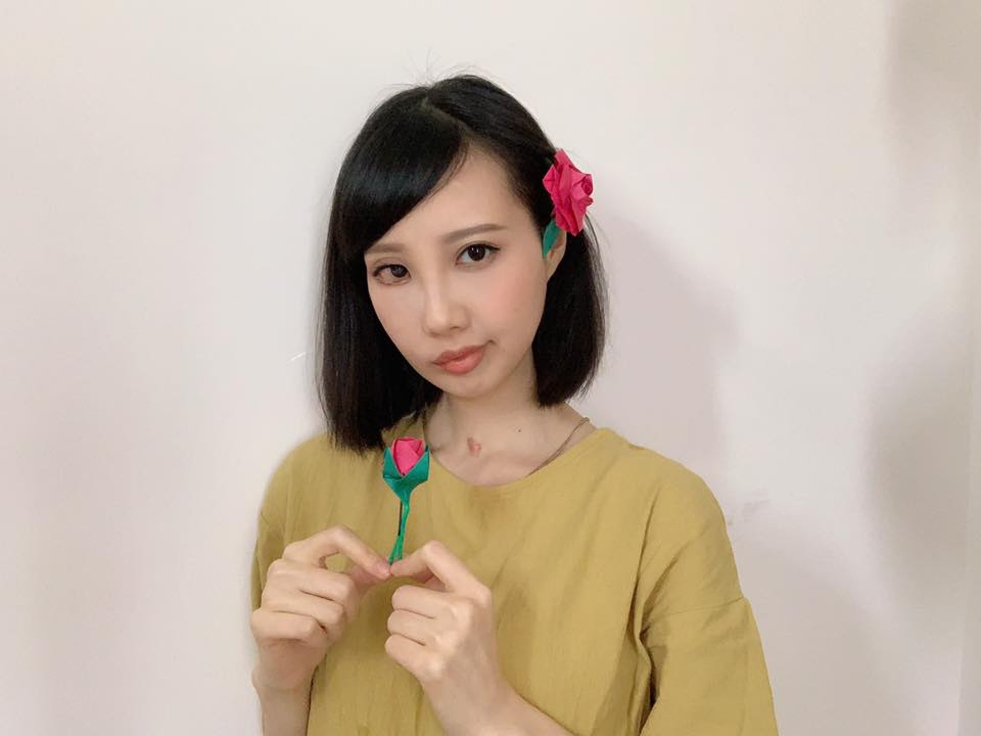 抗癌歌手李明蔚(Sarena)今日不敵罕見癌鼻咽腺樣囊性癌症(4/5)逝世,終年31歲。(李明蔚FB) 抗癌歌手李明蔚(Sarena)今日不敵罕見癌鼻咽腺樣囊性癌症(4/5)逝世,終年31歲。(李明蔚FB)