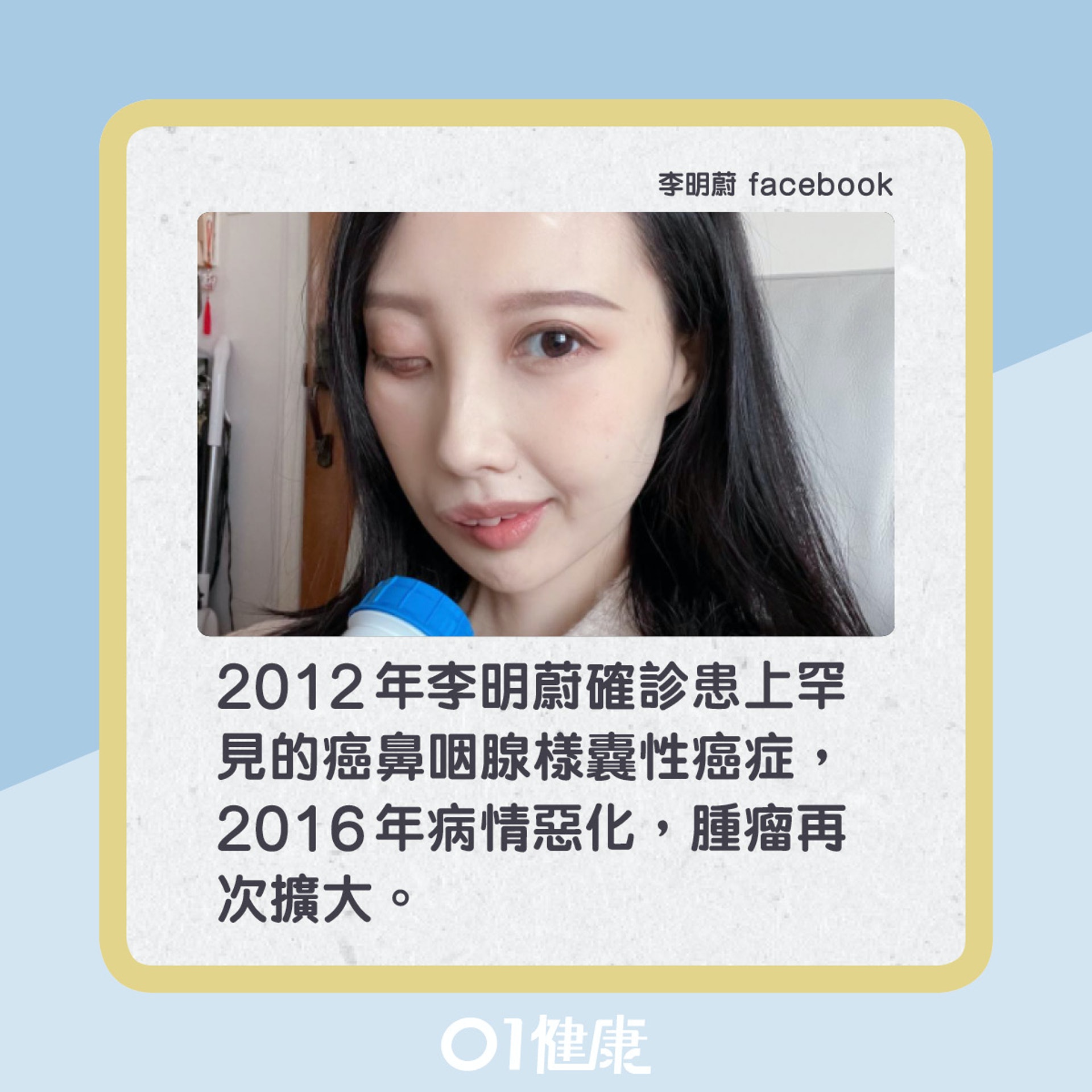 抗癌歌手李明蔚癌症病逝(01製圖) 抗癌歌手李明蔚癌症病逝(01製圖)