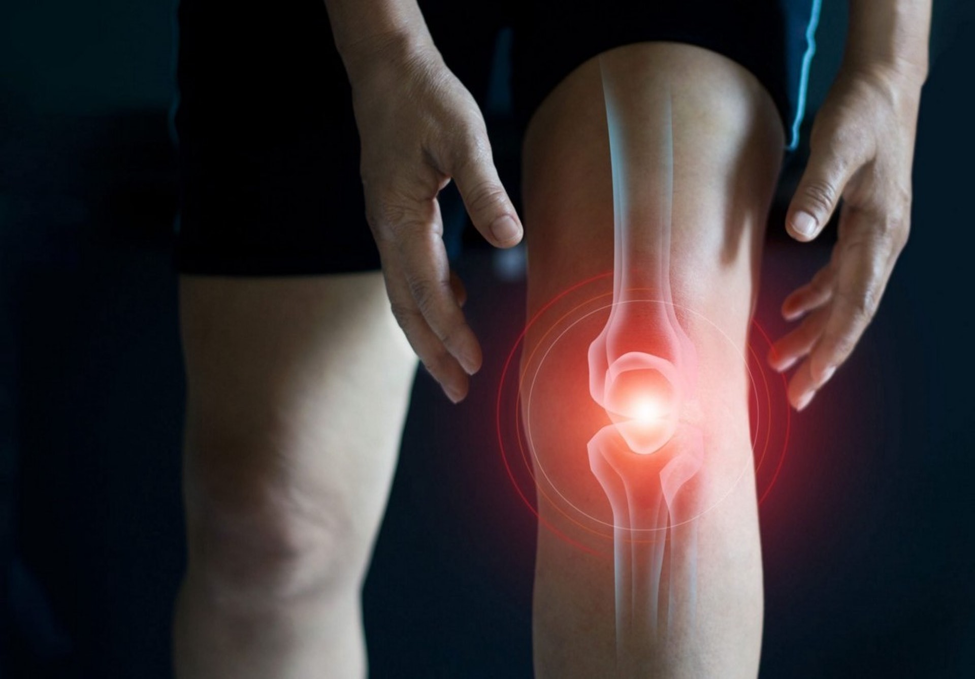 膝頭經常發出聲響，而且連帶出現痛楚，則可能是關節退化的徵兆。（圖片：helloyishi）