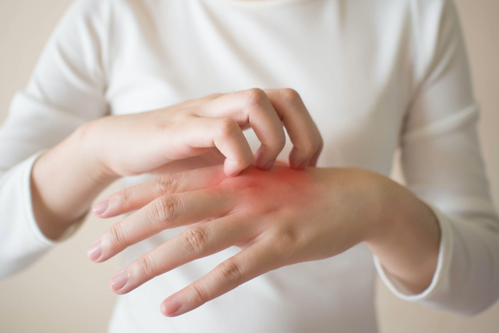 長期使用酒精搓手液消毒或會對皮膚敏感人士造成不適。（圖片：Shutterstock）