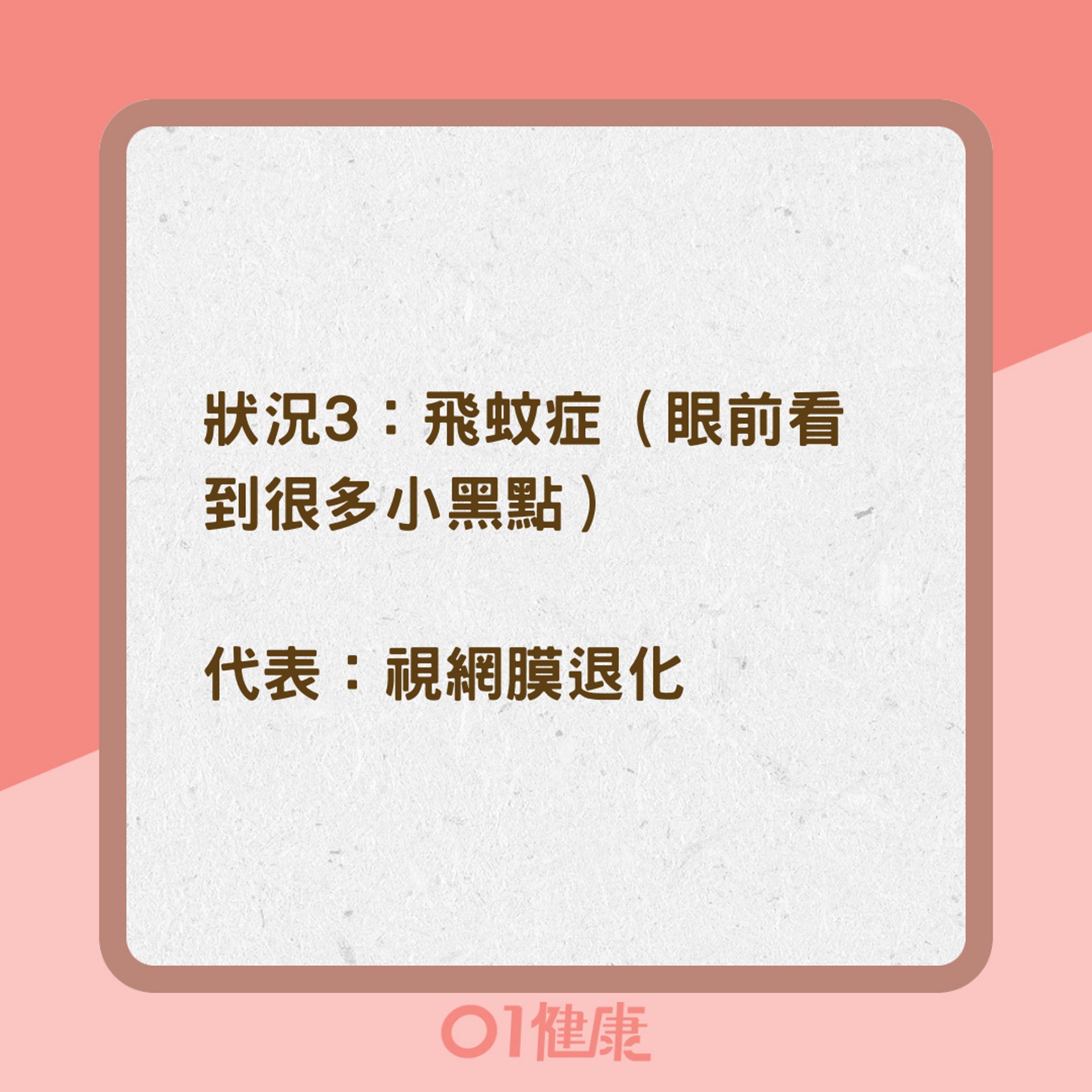 眼睛老化的6大警訊(01製圖) 眼睛老化的6大警訊(01製圖)