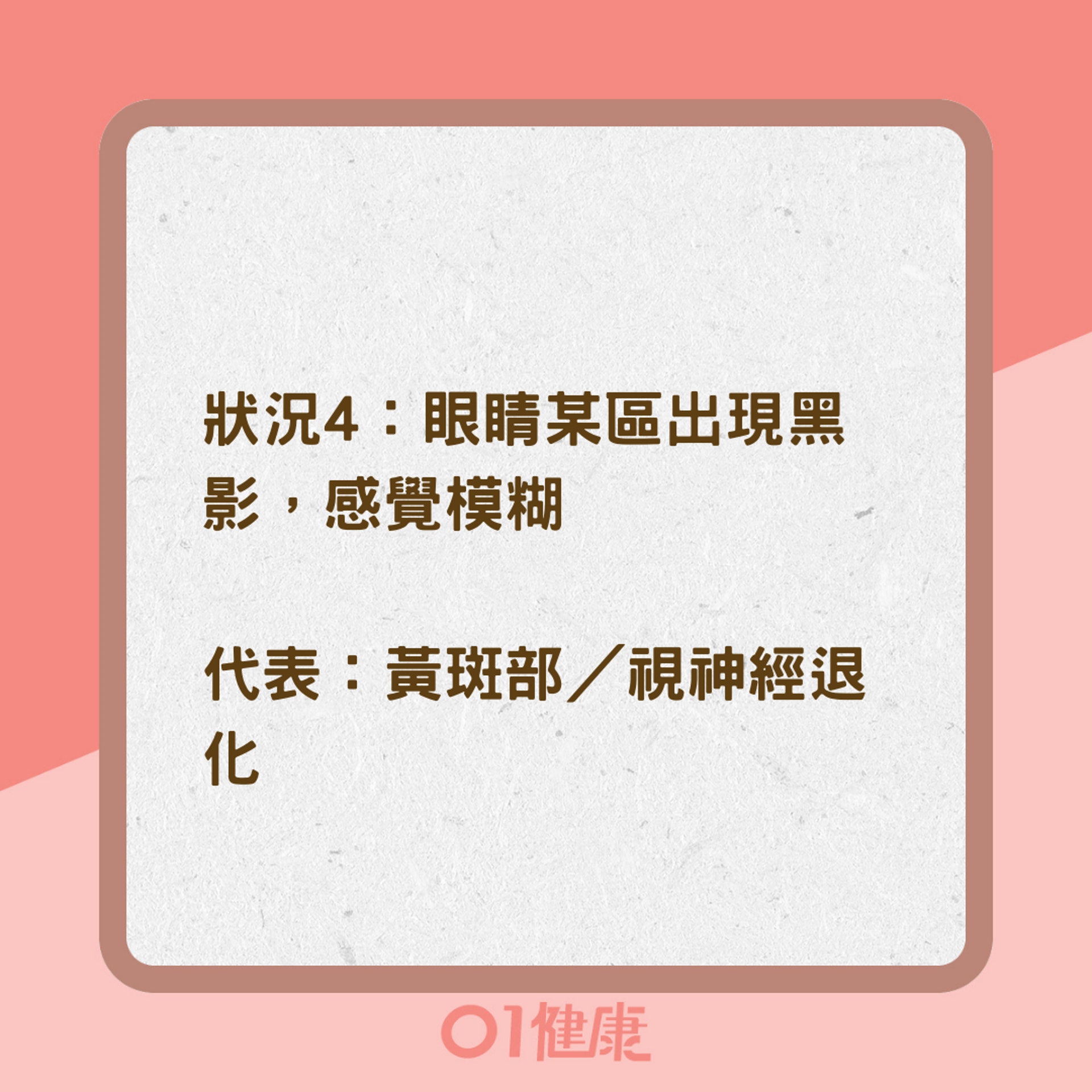 眼睛老化的6大警訊(01製圖) 眼睛老化的6大警訊(01製圖)