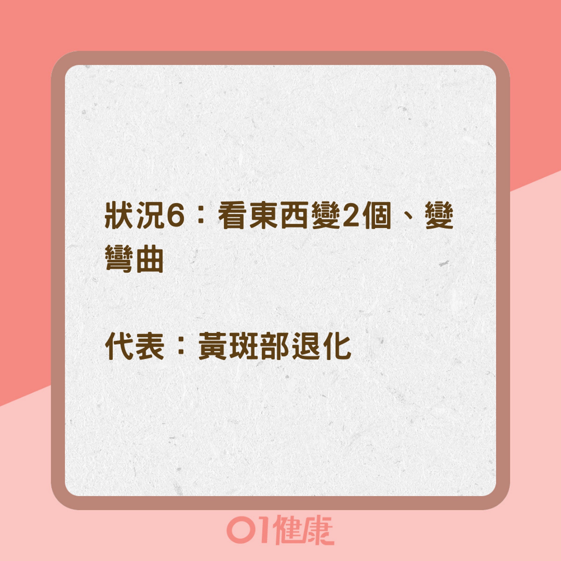 眼睛老化的6大警訊(01製圖) 眼睛老化的6大警訊(01製圖)
