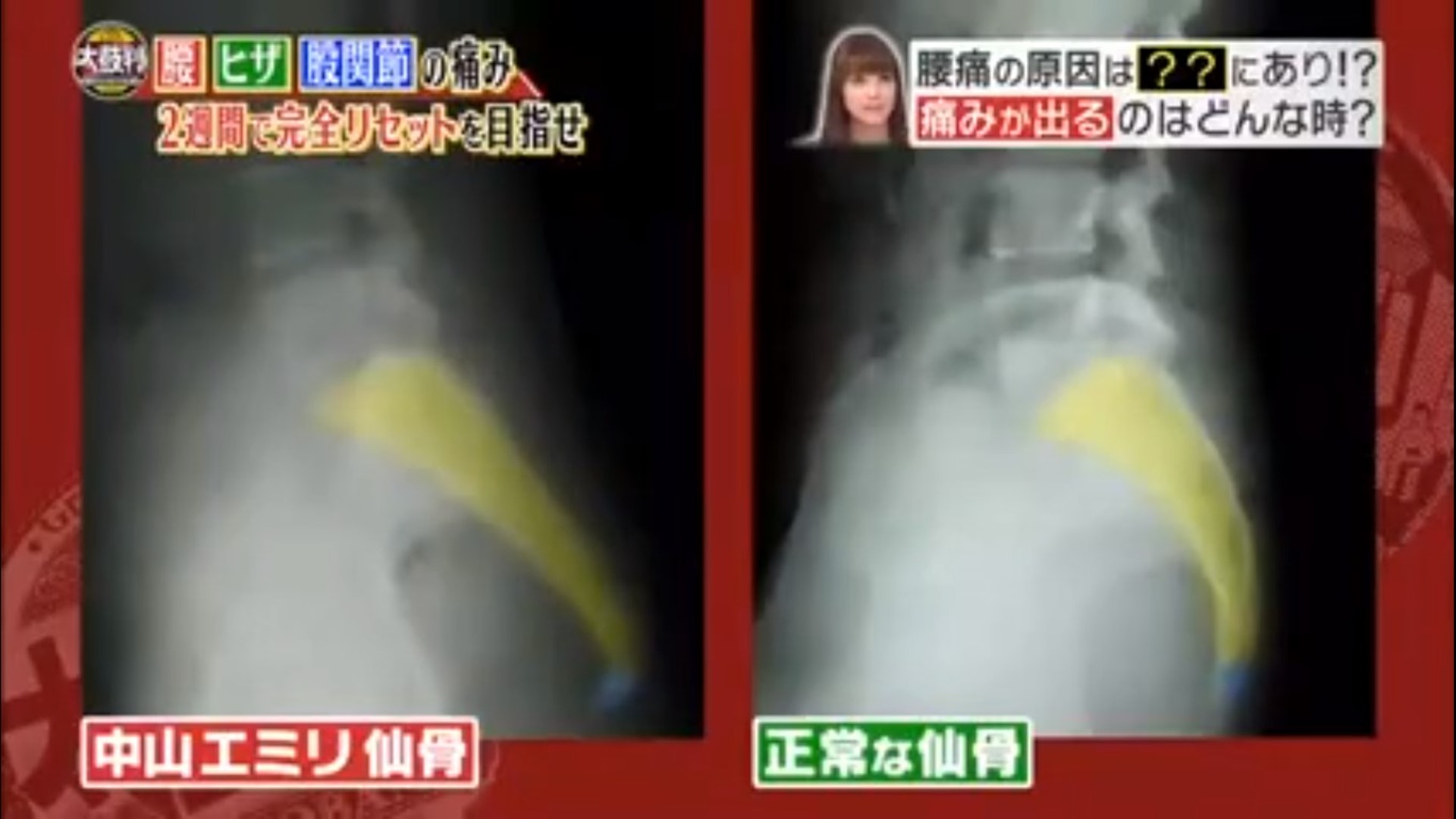 腰痛 煮飯晾衫家居4陷阱易傷腰必學4招爐灶太矮1件神器防腰痛 香港01 健康 腰痛 煮飯晾衫家居4陷阱易傷腰必學4招爐灶太矮1件神器防腰痛 香港01 健康