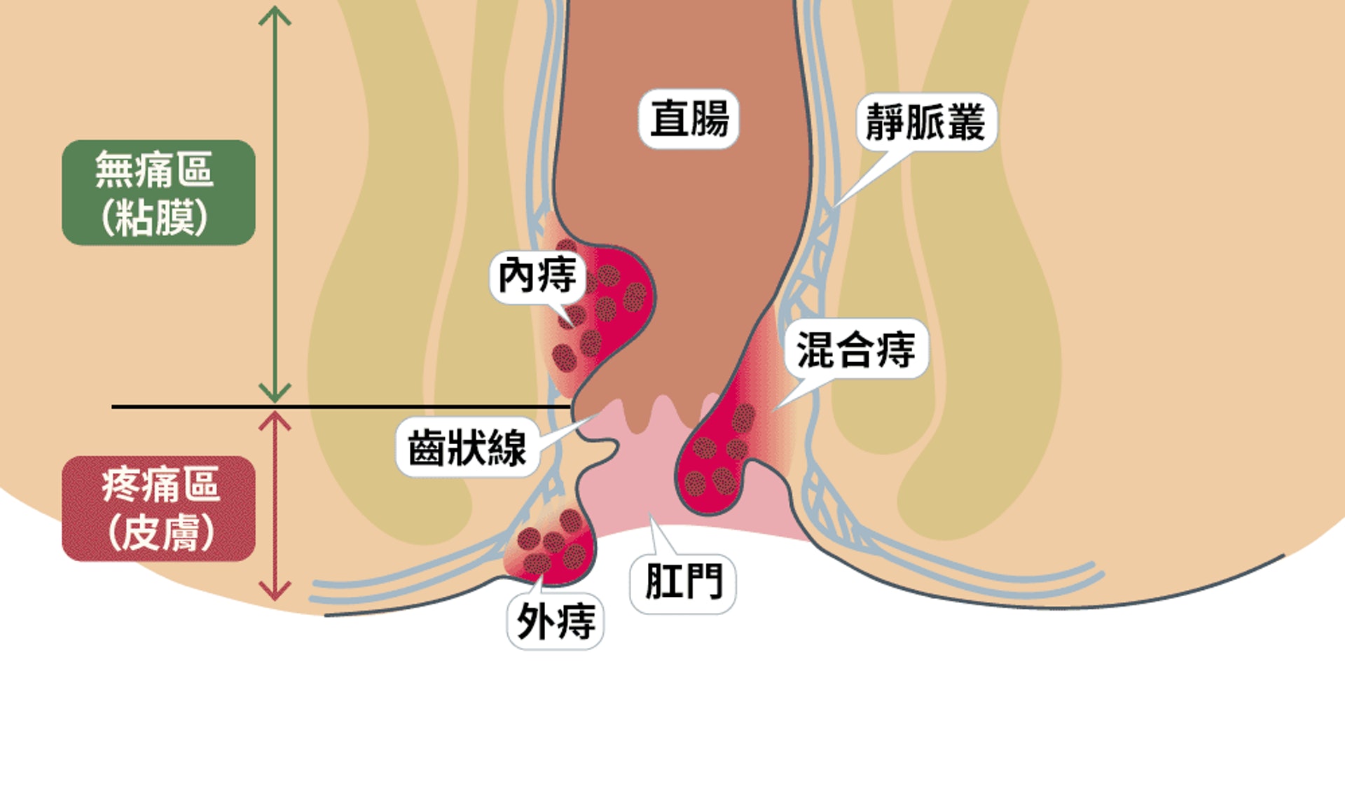 (圖片:ihealth) (圖片:ihealth)