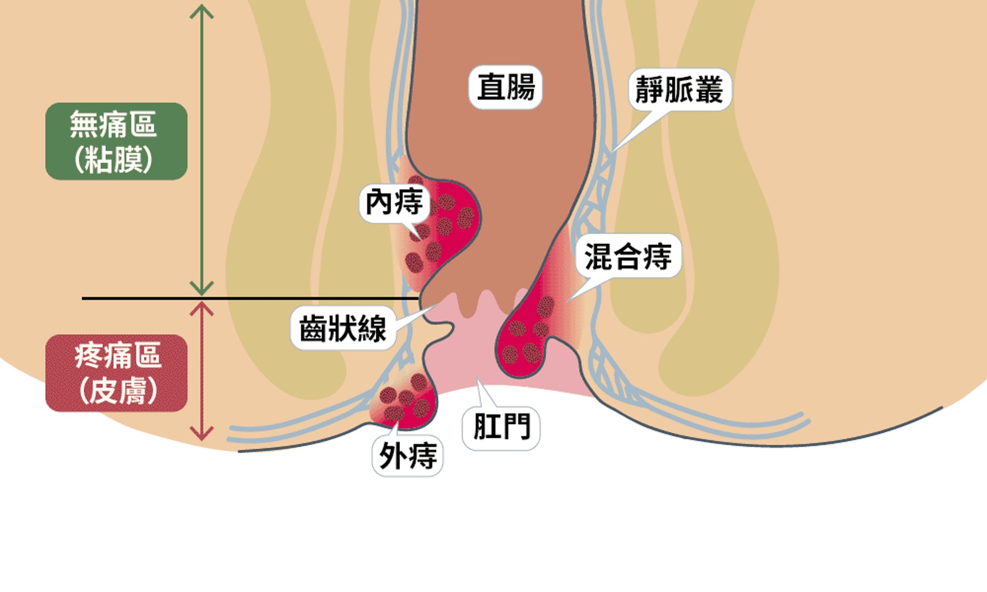 （圖片：ihealth）