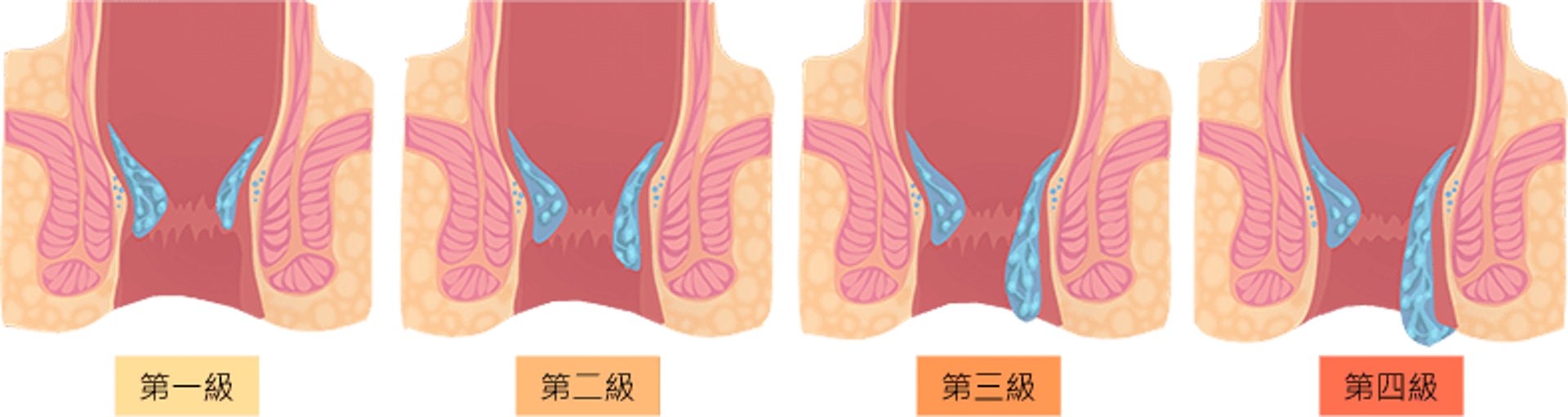 （圖片：hemordr）