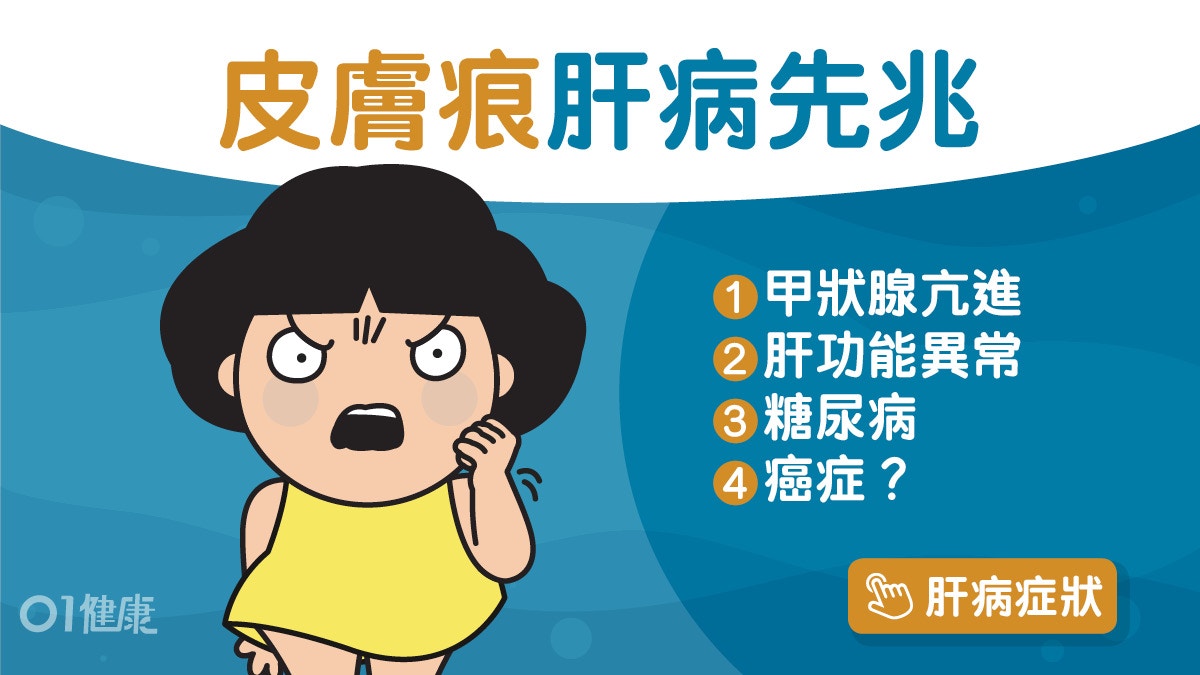 皮膚痕｜糖尿病高血壓8症狀都會皮膚痕？嚴重瘙癢或患肝癌腸癌！