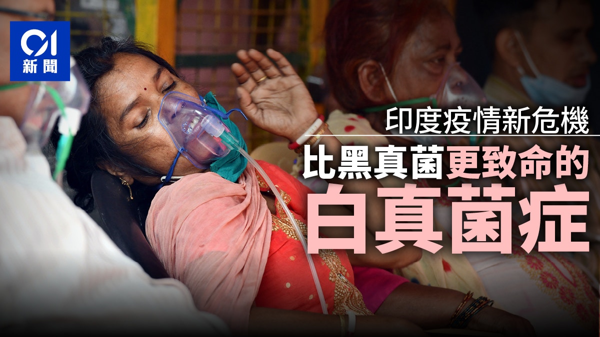 新冠肺炎 印度現 白真菌症 病例專家 較黑真菌更危險 香港01 即時國際 新冠肺炎 印度現 白真菌症 病例專家 較黑真菌更危險 香港01 即時國際