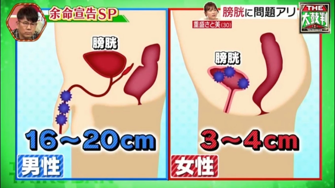女性較男性容易患上膀胱炎的原因關乎到尿道的長度，男性有16-20厘米，然而女性卻只有3-4厘米，更易受細菌入侵。（《名医のTHE太鼓判！》截圖）