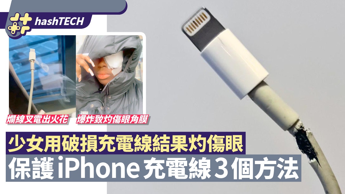 少女用破損iPhone充電線爆炸灼傷眼　Lightning線為何易爛2個原因