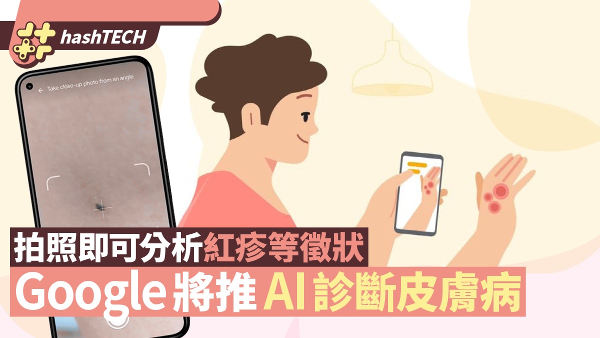 皮膚病︱Google將推AI診斷相關病症 拍攝照片即可分析相符徵狀 皮膚病︱Google將推AI診斷相關病症 拍攝照片即可分析相符徵狀