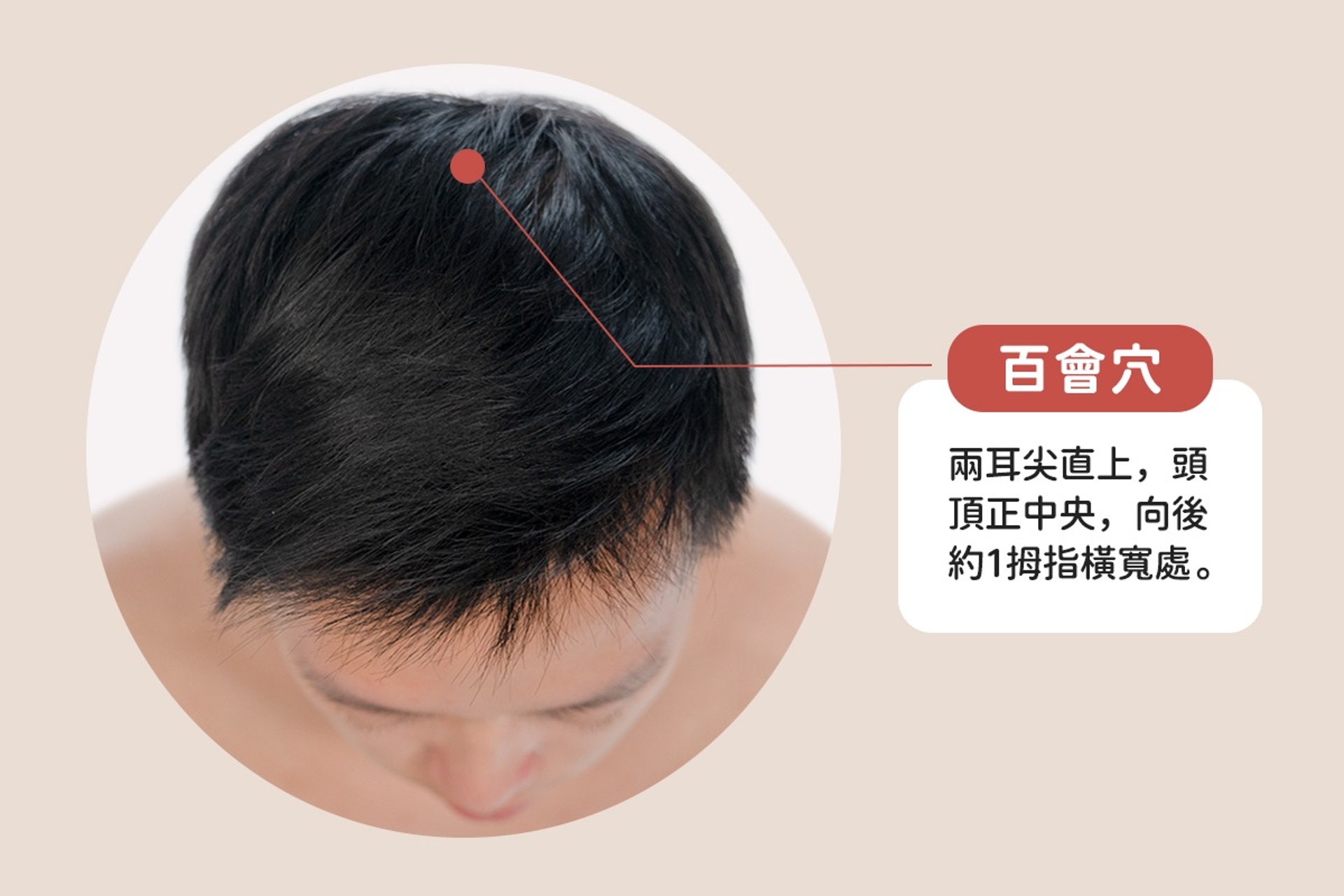 「百會穴」位於頭頂正中央,按壓有助止暈、醒腦提神、促進新陳代謝。濕氣較重的人士,按壓時的痠感會特別明顯。(圖片:epochtimes) 「百會穴」位於頭頂正中央,按壓有助止暈、醒腦提神、促進新陳代謝。濕氣較重的人士,按壓時的痠感會特別明顯。(圖片:epochtimes)