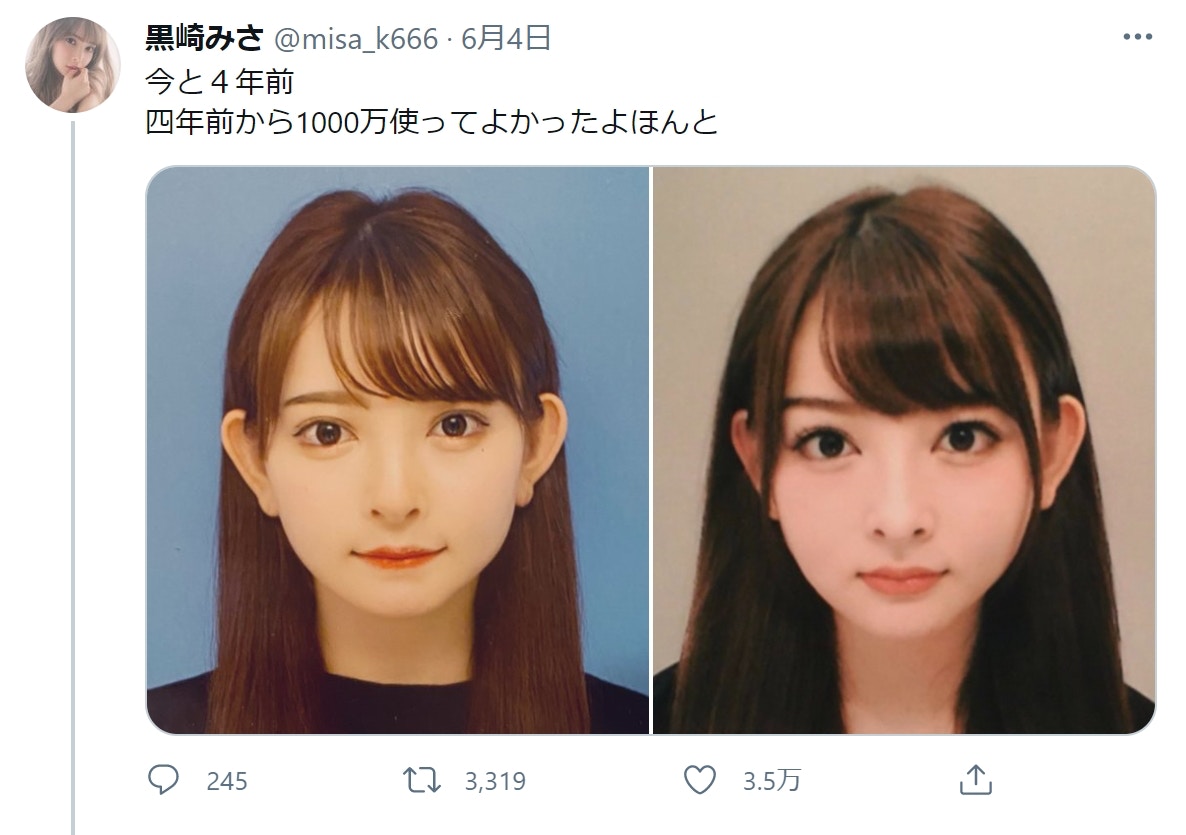 黑崎美紗分享花千萬整容前照片，網民紛紛表示「差在哪」、「這樣要花1000萬？」。（Twitter@misa_k666）