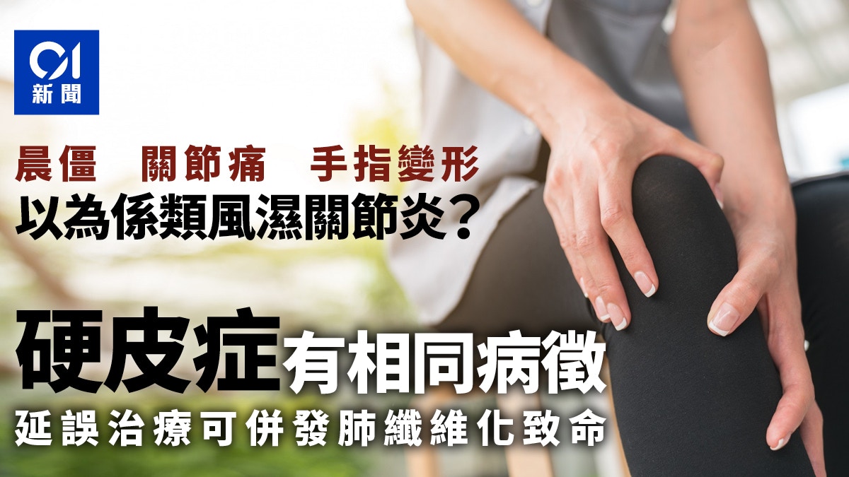 硬皮症病徵似類風濕關節炎 延誤治療可併發肺纖維化致命
