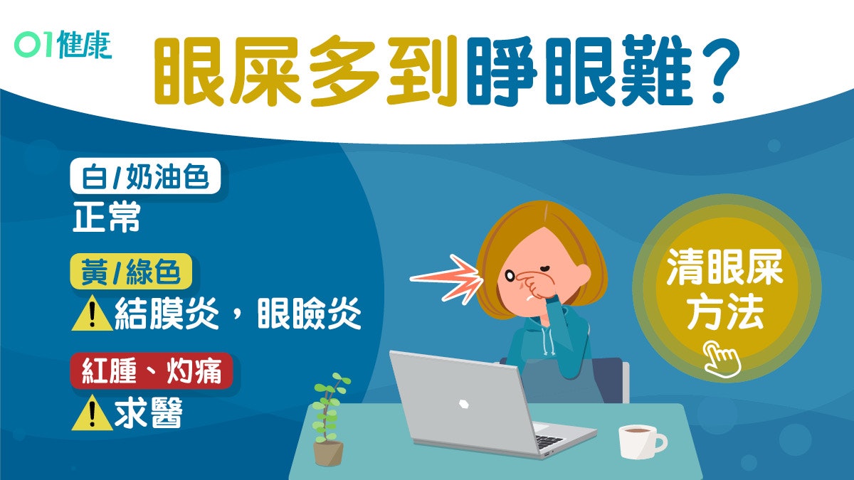 眼屎|黃綠色眼屎或染結膜炎?教1招清潔眼屎防感染勿再用手指! 眼屎|黃綠色眼屎或染結膜炎?教1招清潔眼屎防感染勿再用手指!