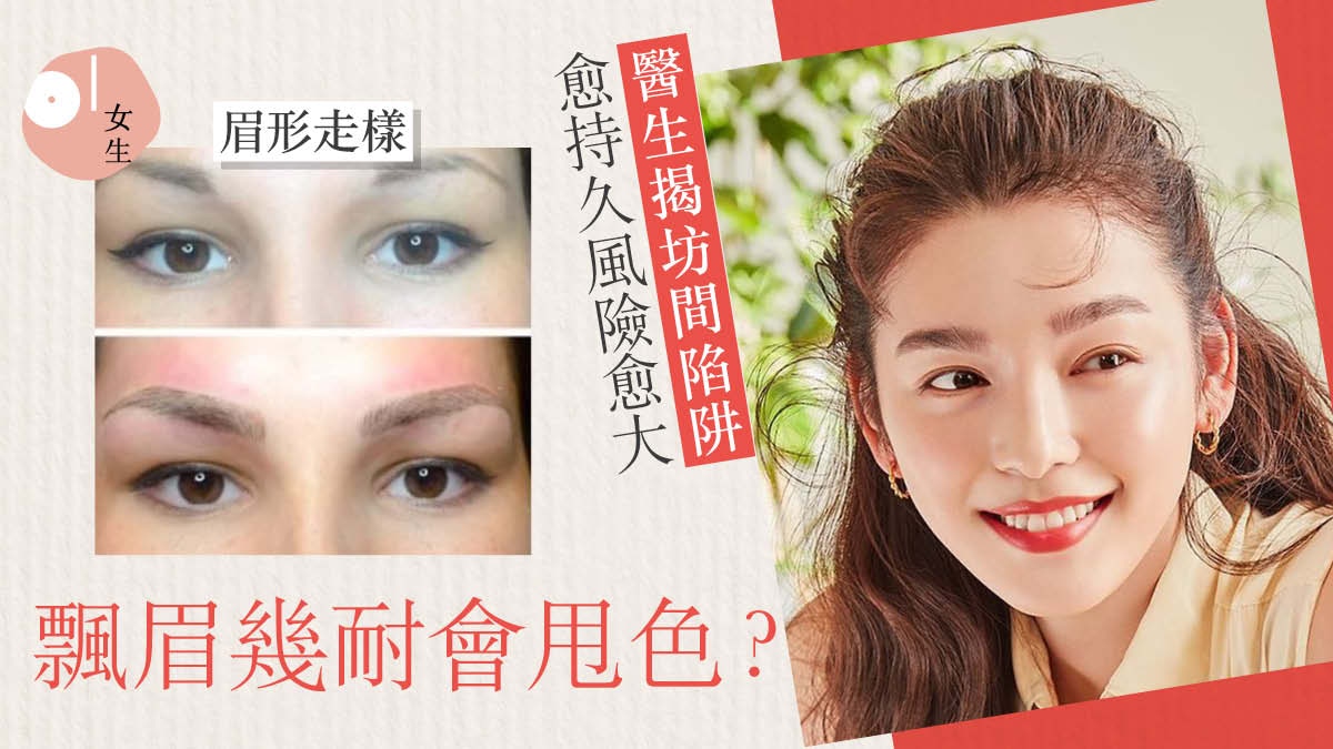 飄眉 女生眉形走樣引共鳴醫生公開5大須知 額頭長暗瘡勿飄眉 香港01 美容手帳 飄眉 女生眉形走樣引共鳴醫生公開5大須知 額頭長暗瘡勿飄眉 香港01 美容手帳