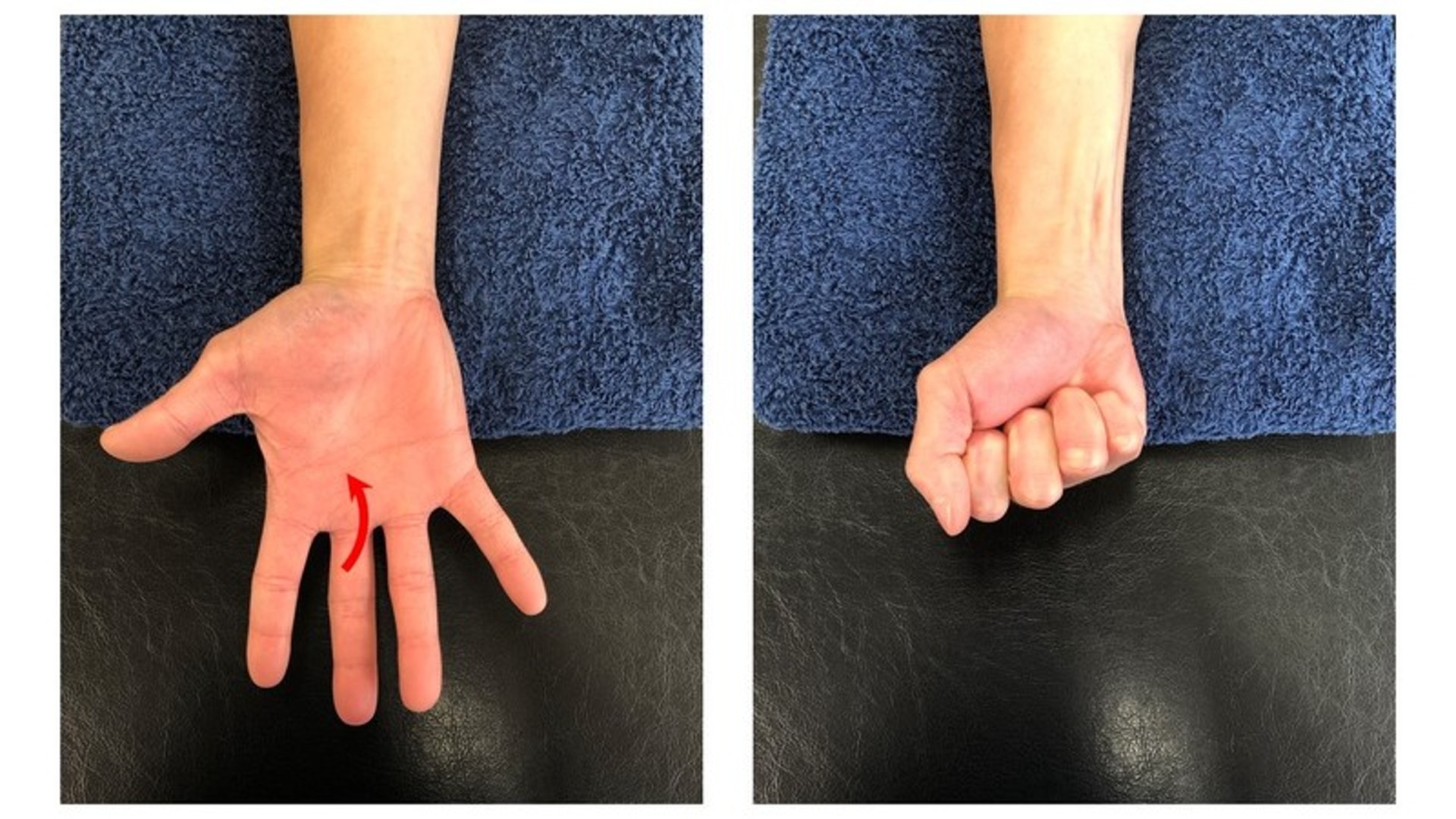 每日進行手部伸展動作，如將手掌、手指盡量打開再收起，有助舒展筋骨。（圖片：AR-Ex Medical Group）