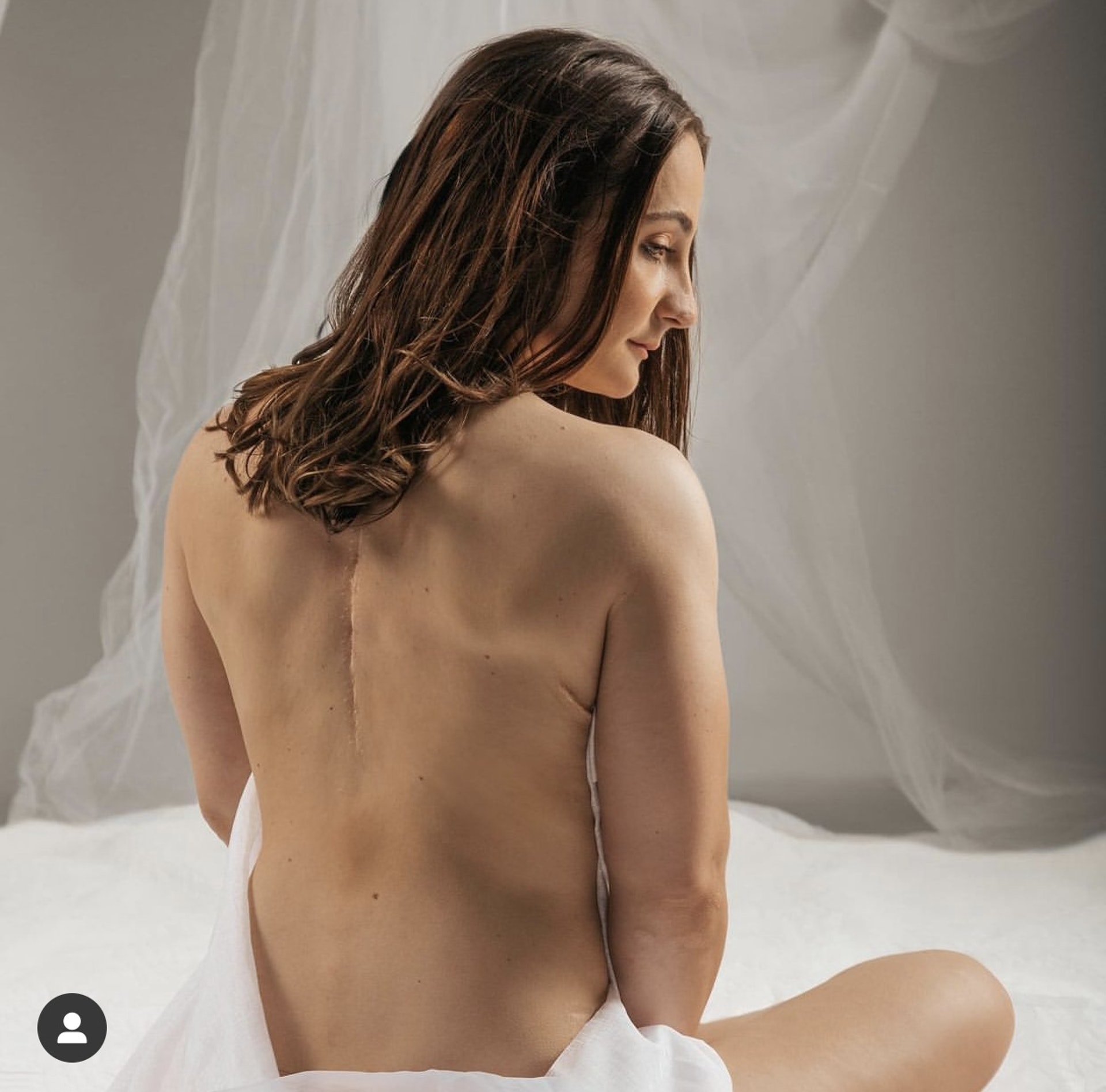 禾高說,缺憾是美麗的。(kristina.vogel Instagram) 禾高說,缺憾是美麗的。(kristina.vogel Instagram)