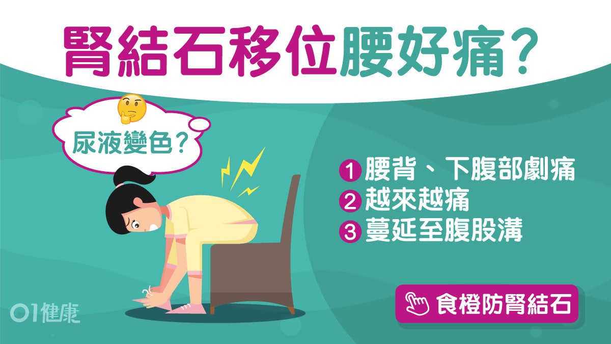 腎結石|發燒腰背痛尿頻6症狀 6飲食習慣防結石少吃菠菜朱古力? 腎結石|發燒腰背痛尿頻6症狀 6飲食習慣防結石少吃菠菜朱古力?