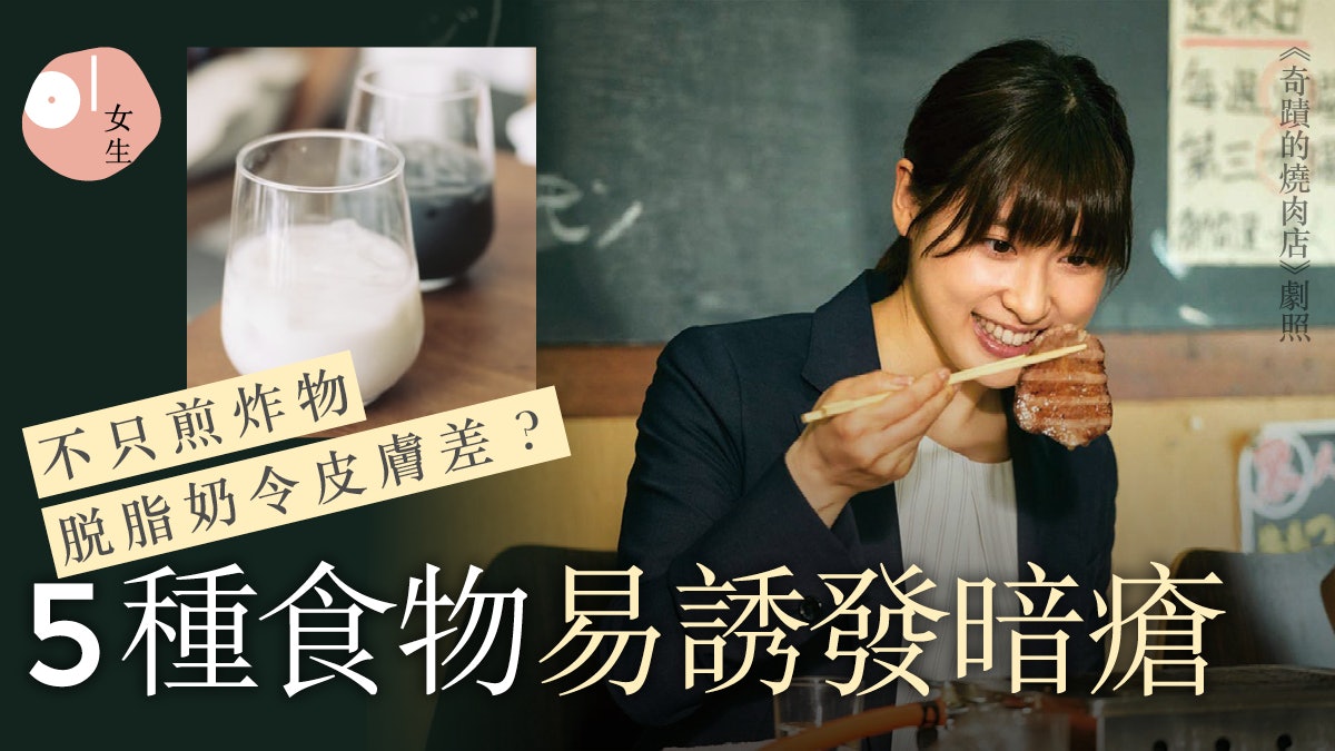 暗瘡|改善「暗瘡肌」戒5類食物 護理暗瘡分3階段暗瘡貼幾時用? 暗瘡|改善「暗瘡肌」戒5類食物 護理暗瘡分3階段暗瘡貼幾時用?