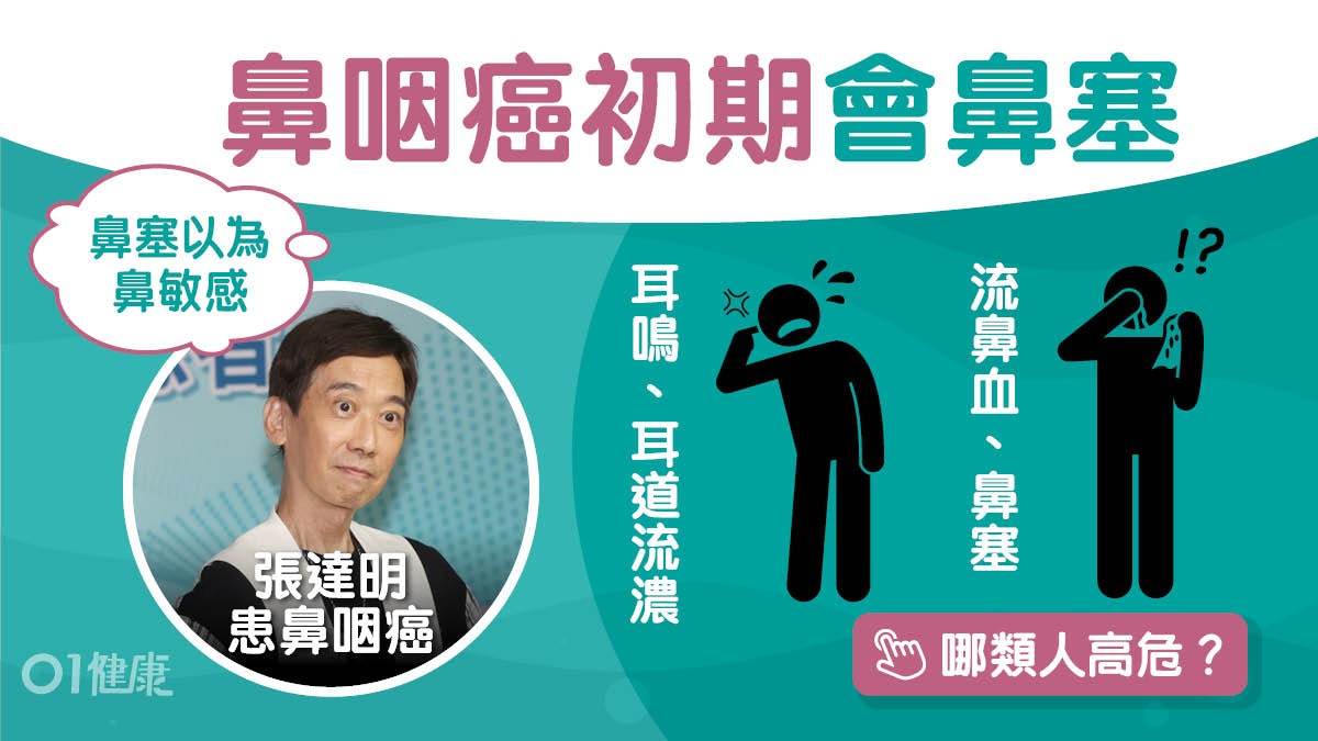 鼻咽癌|張達明康復中餘6成聽力 鼻咽癌初期鼻塞5大徵狀常流鼻血 鼻咽癌|張達明康復中餘6成聽力 鼻咽癌初期鼻塞5大徵狀常流鼻血