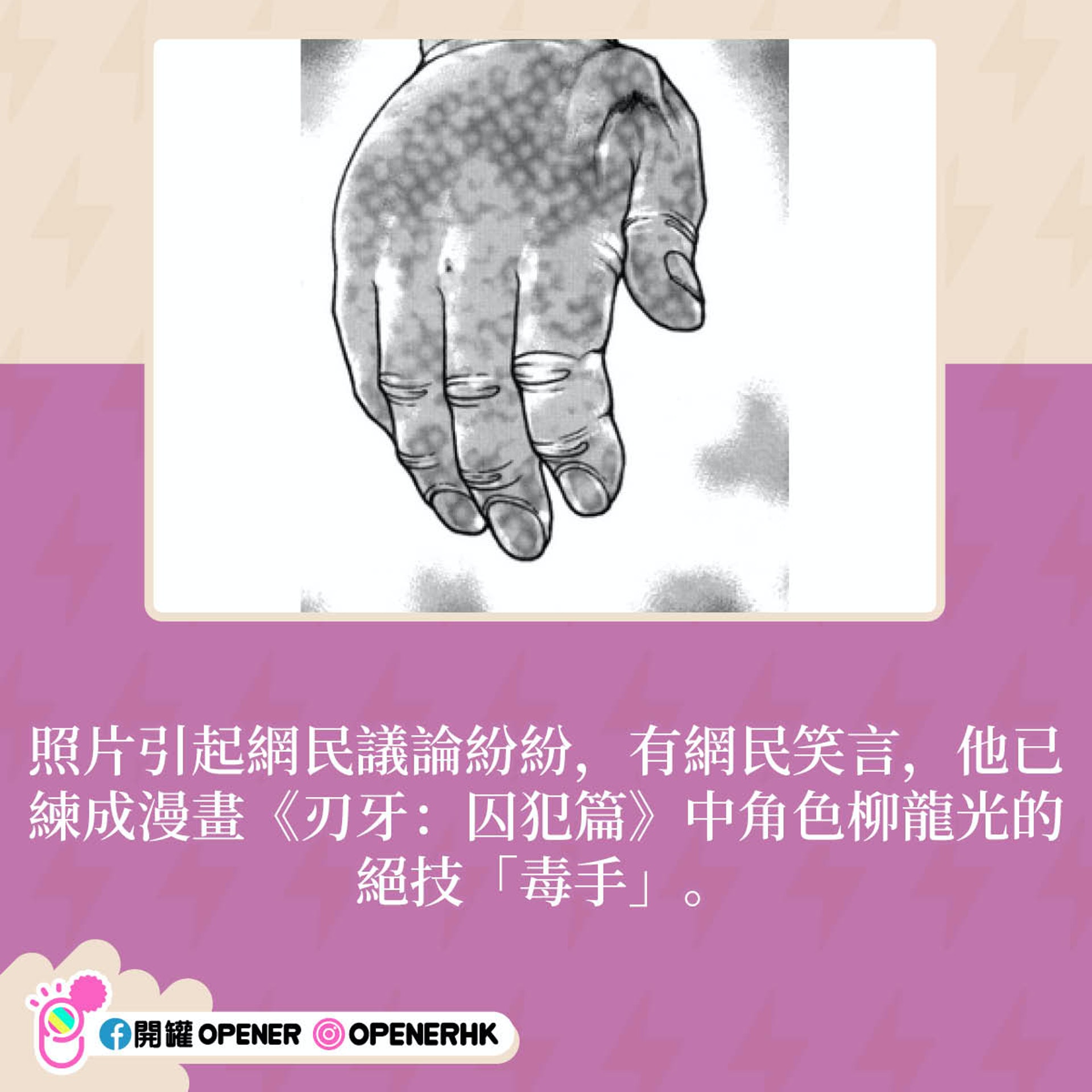 男生跟SP大戰後手指甲生性病腫到去下巴 醫生睇完相後揭另有內情 男生跟SP大戰後手指甲生性病腫到去下巴 醫生睇完相後揭另有內情