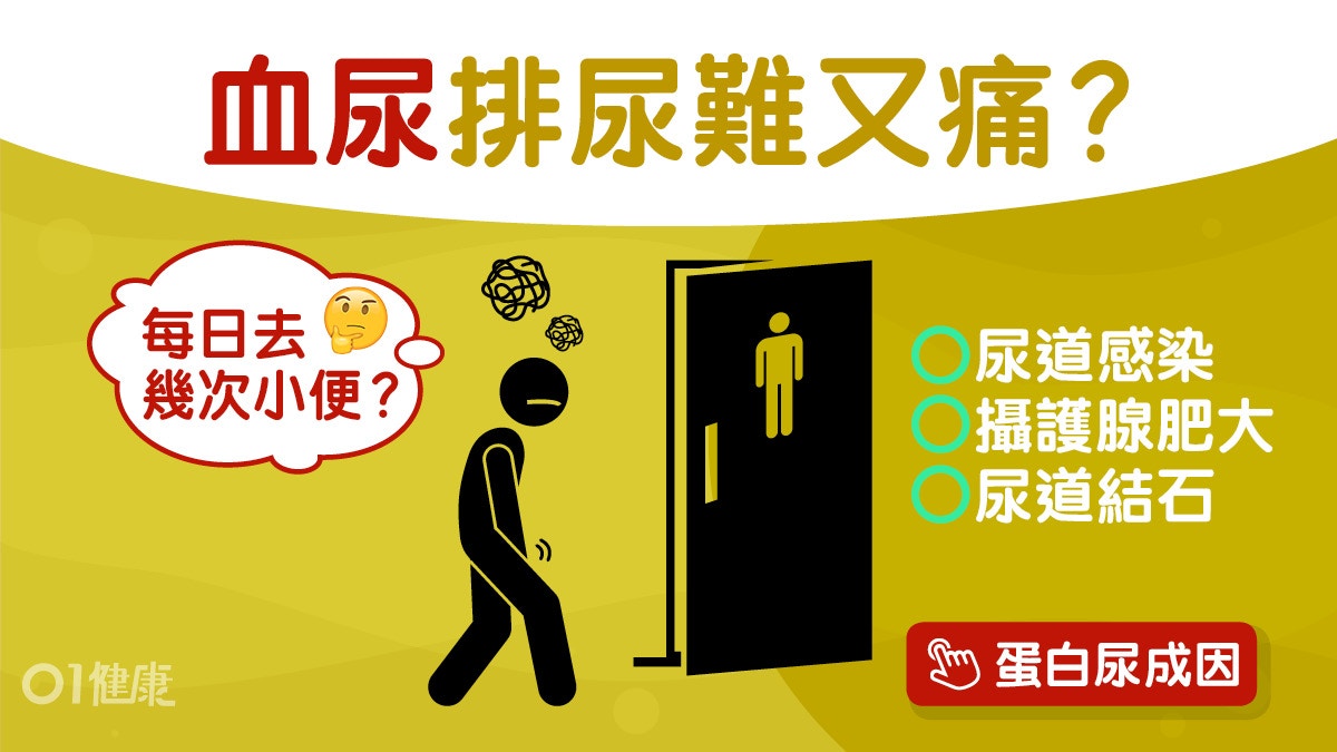 血尿 尿道感染結石3症狀致血尿嚴重可致泌尿道癌幾耐驗尿1次 香港01 健康