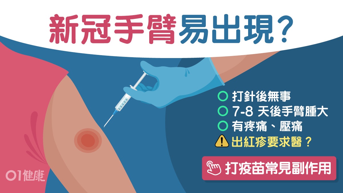 新冠疫苗|打針後現「新冠手臂」紅腫癢痛5症狀 醫師3招教冰敷? 新冠疫苗|打針後現「新冠手臂」紅腫癢痛5症狀 醫師3招教冰敷?