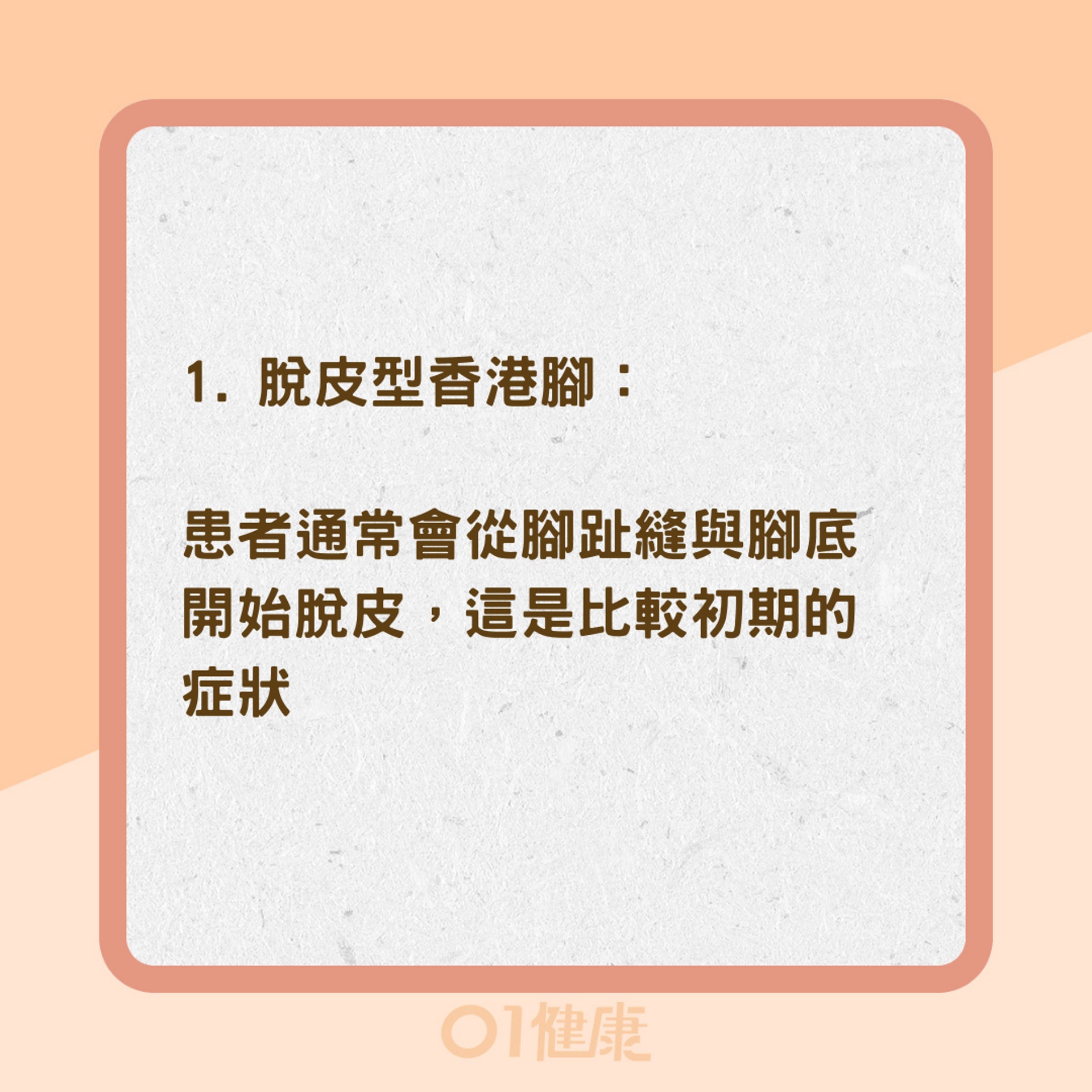 四種香港腳類型和症狀(01製圖) 四種香港腳類型和症狀(01製圖)