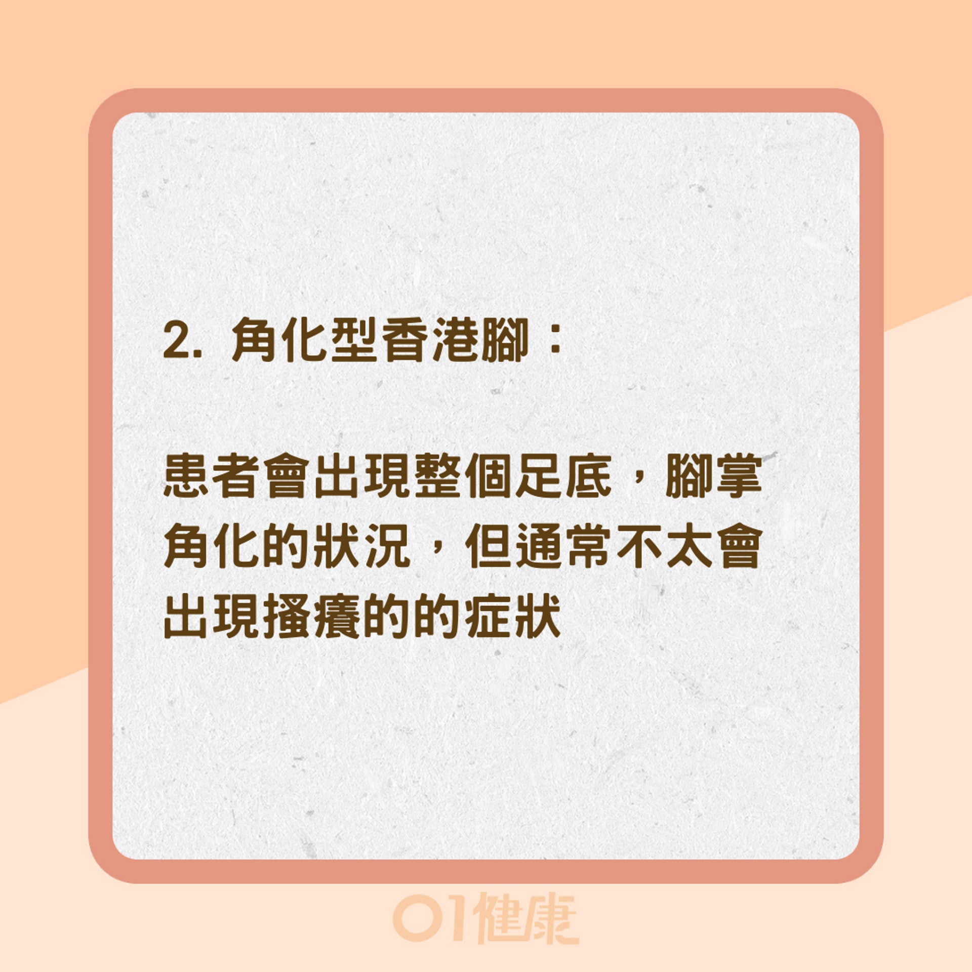 四種香港腳類型和症狀(01製圖) 四種香港腳類型和症狀(01製圖)